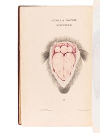 BURROWS, George (1832-1909). On Disorders of the Cerebral Circulation; And on the Connection between Affections of the Brain and Diseases of the Heart. London: Longman, Brown, Green, and Longmans, 1846.