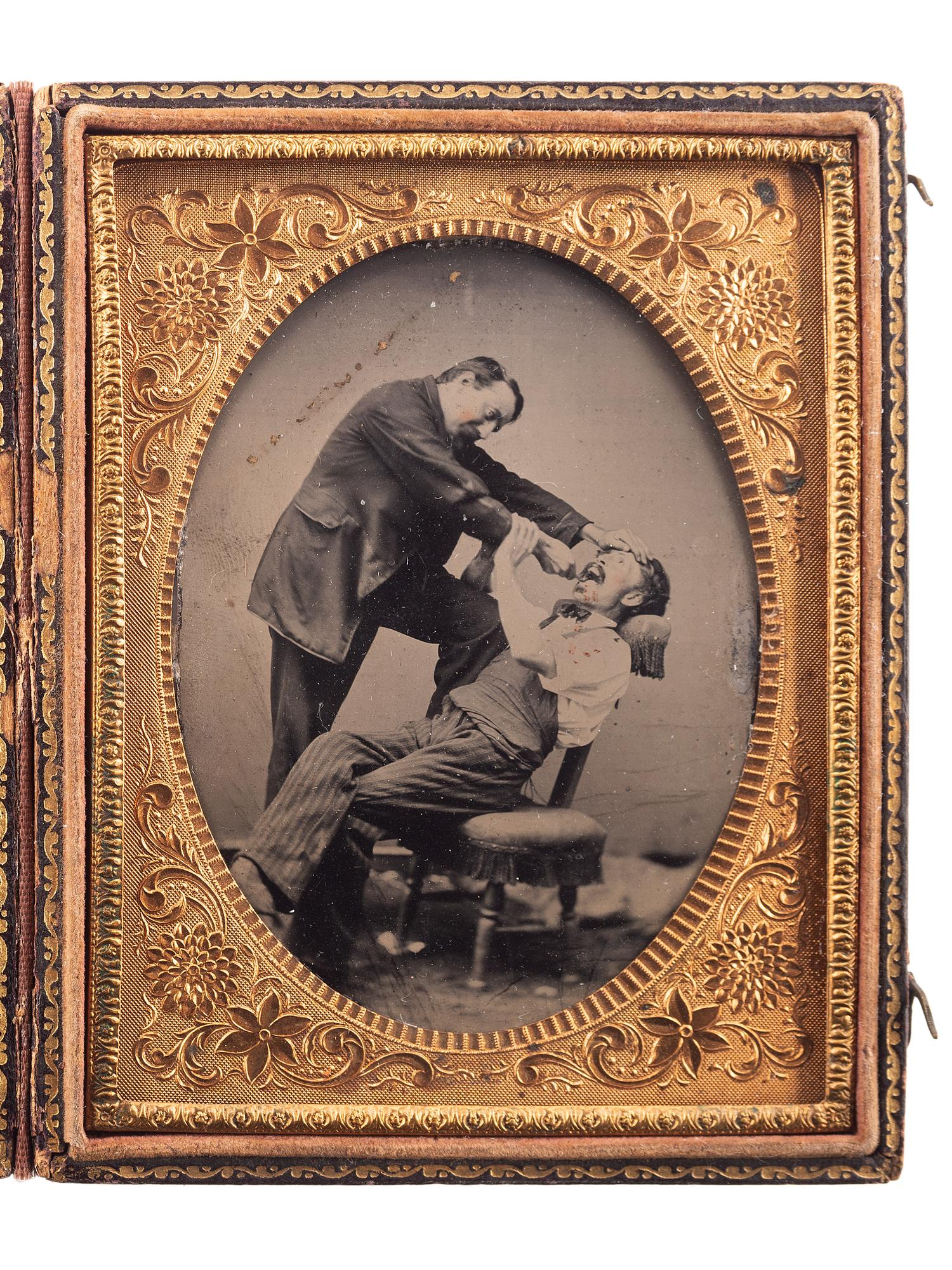 [EARLY PHOTOGRAPHY]. Sixth plate occupational tintype of two friends in a humorous pose, pretending to extract a tooth.