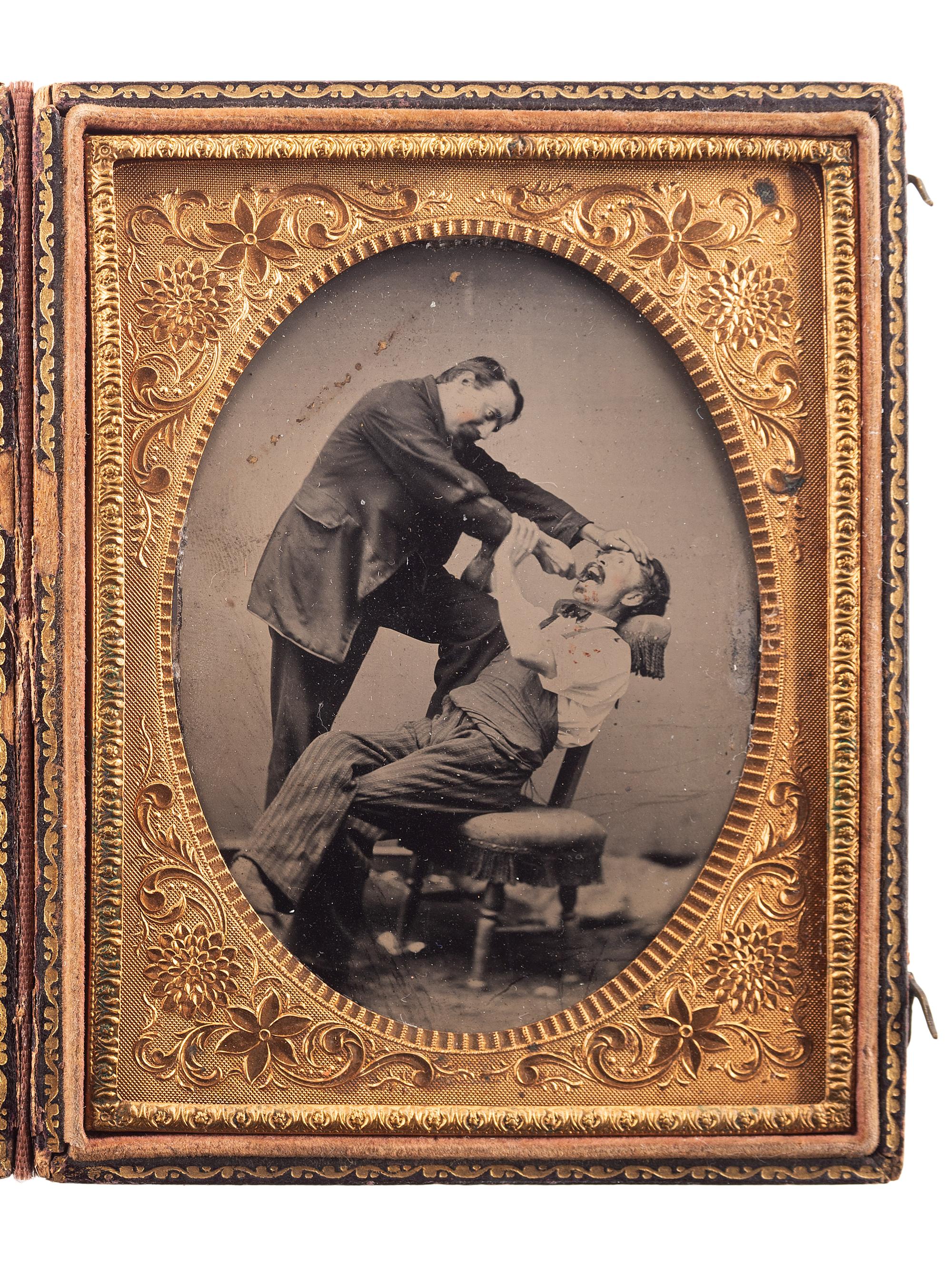 [EARLY PHOTOGRAPHY]. Sixth plate occupational tintype of two friends in a humorous pose, pretending to extract a tooth.