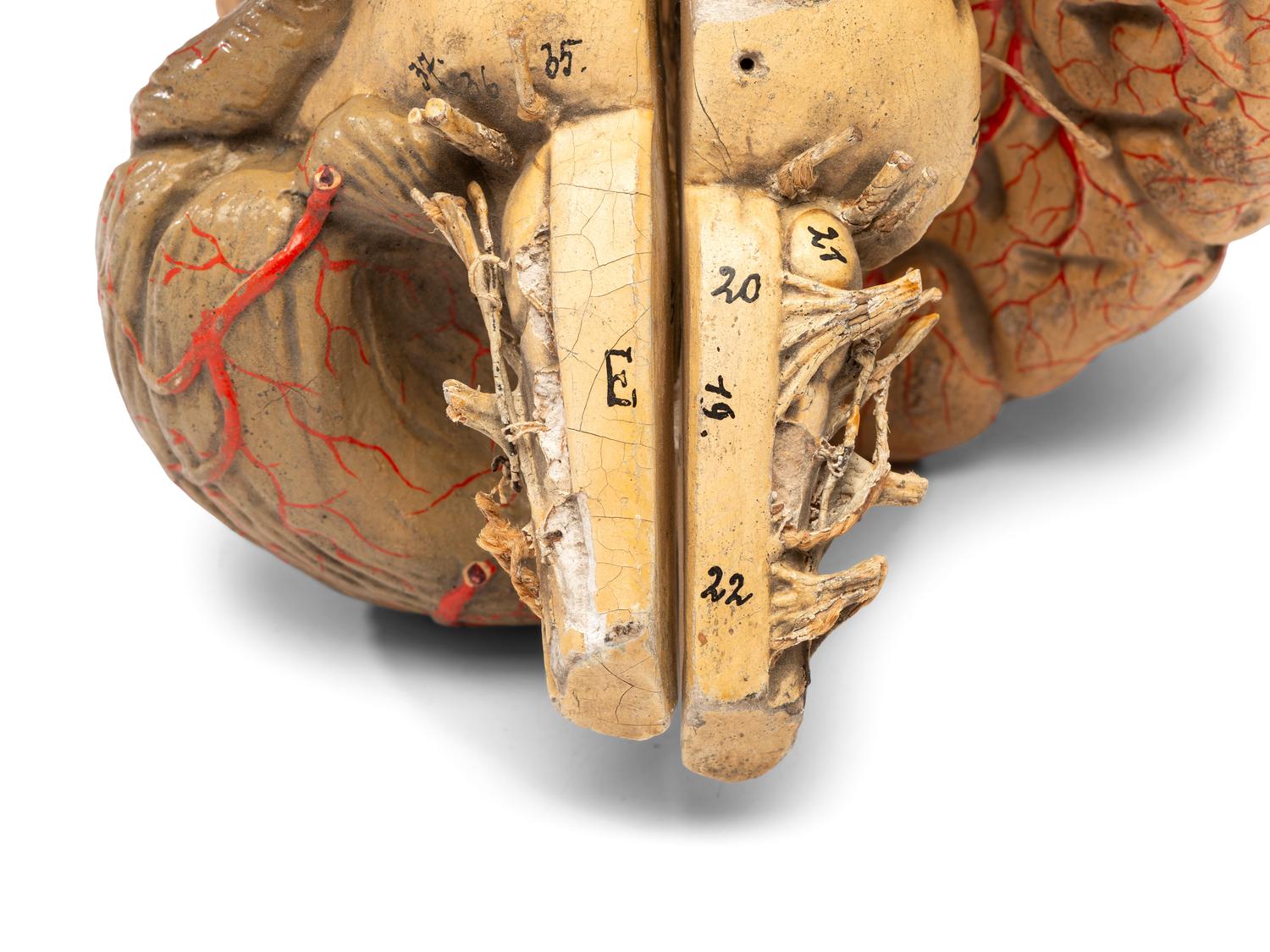 A Painted Plaster Brain Section Model