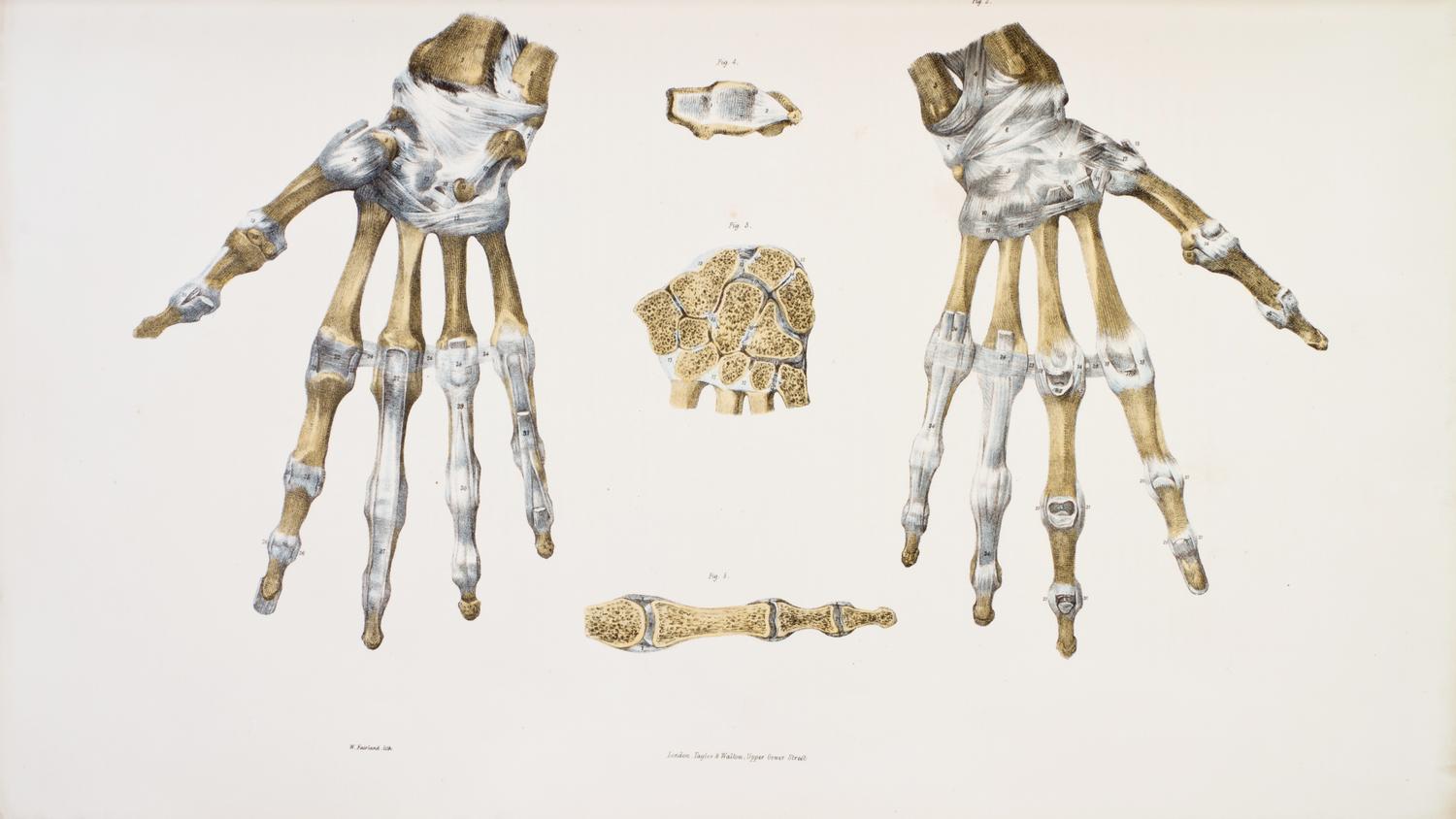 (ANATOMY) QUAIN, J. AND E. WILSON, eds. A Series of Anatomical Plates... London, 1836-1842. 3 (of 5) vols. in one. First editions.