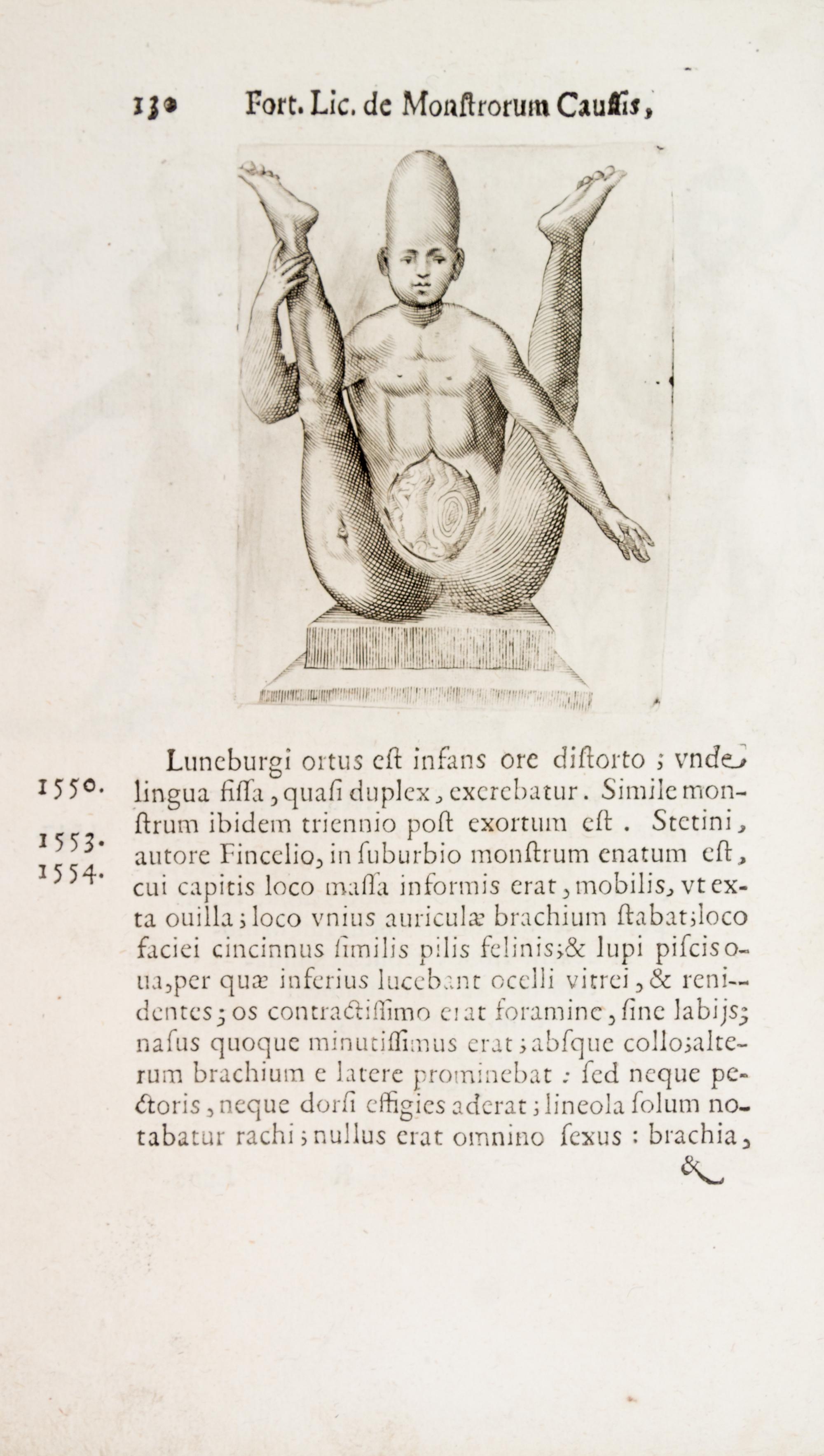 LICETUS, FORTUNIS. De monstrorum natura... Padua, 1634. First illustrated ed. of a work on "monsters" or physical deformities.