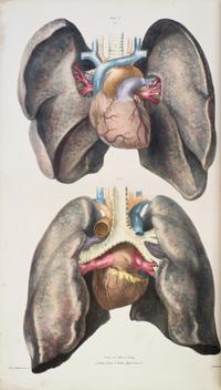 (ANATOMY) QUAIN, J. AND E. WILSON, eds. A Series of Anatomical Plates... London, 1836-1842. 3 (of 5) vols. in one. First editions.