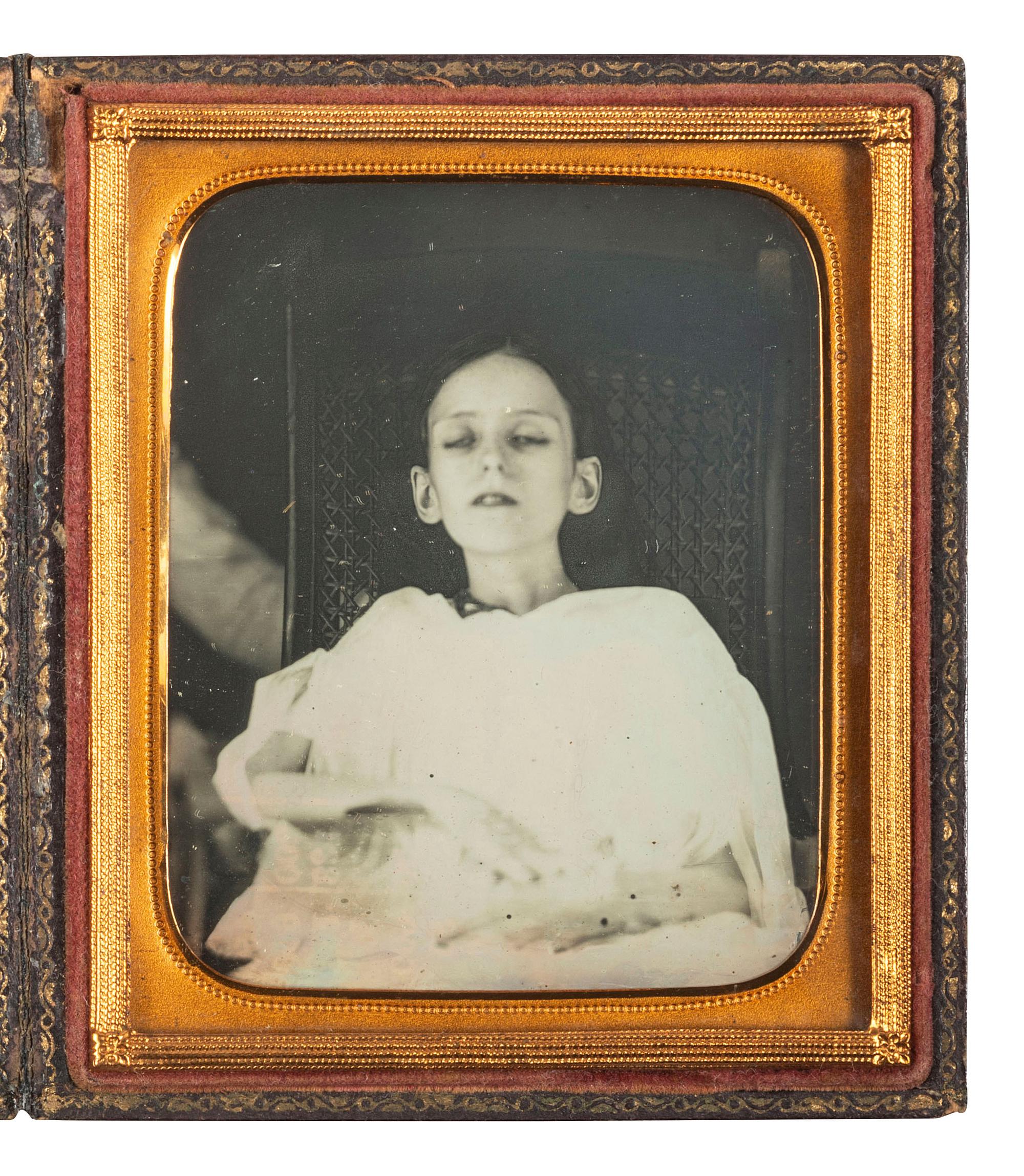 [EARLY PHOTOGRAPHY]. Sixth plate postmortem daguerreotype of a child sitting in a chair.