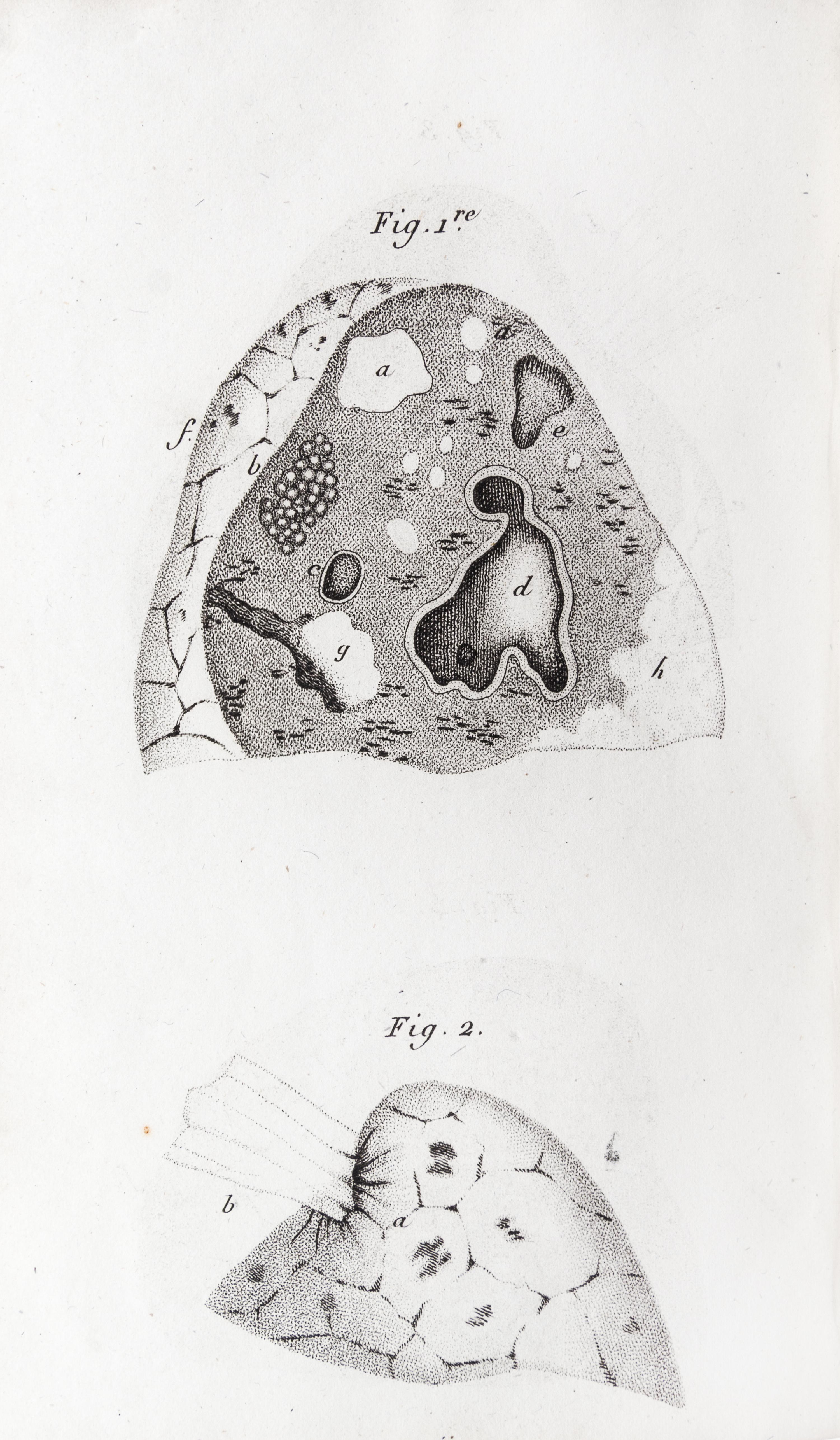 LAENNEC, R.T. Traite de L'Auscultation mediate... Paris, 1826. 2 vols. Second edition.
