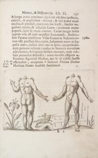LICETUS, FORTUNIS. De monstrorum natura... Padua, 1634. First illustrated ed. of a work on "monsters" or physical deformities.