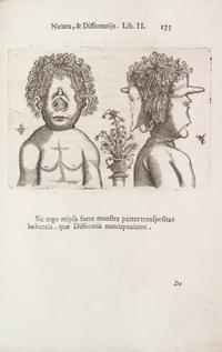 LICETUS, FORTUNIS. De monstrorum natura... Padua, 1634. First illustrated ed. of a work on "monsters" or physical deformities.