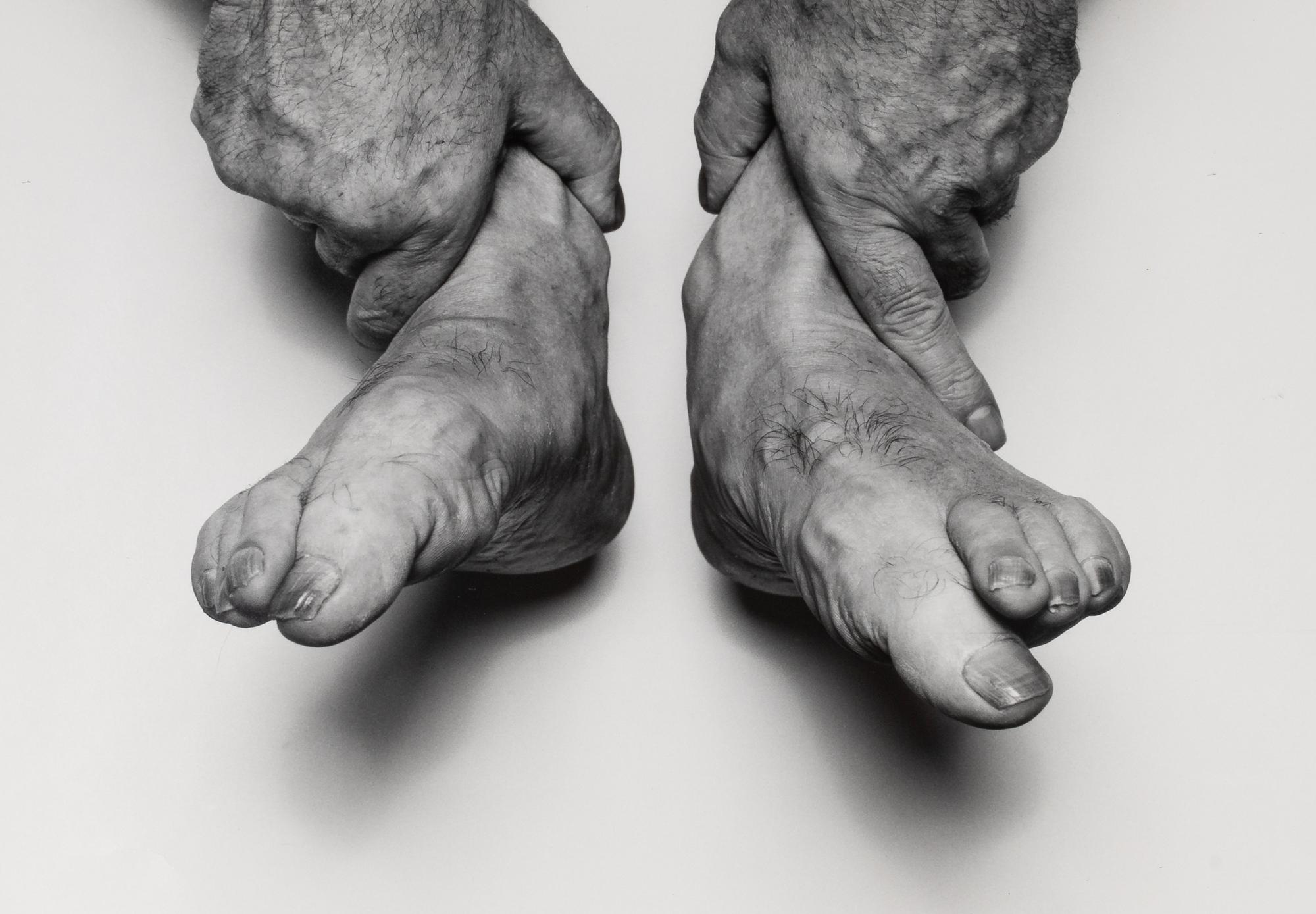 John Coplans (1920-2003) Hands Holding Feet, 1985