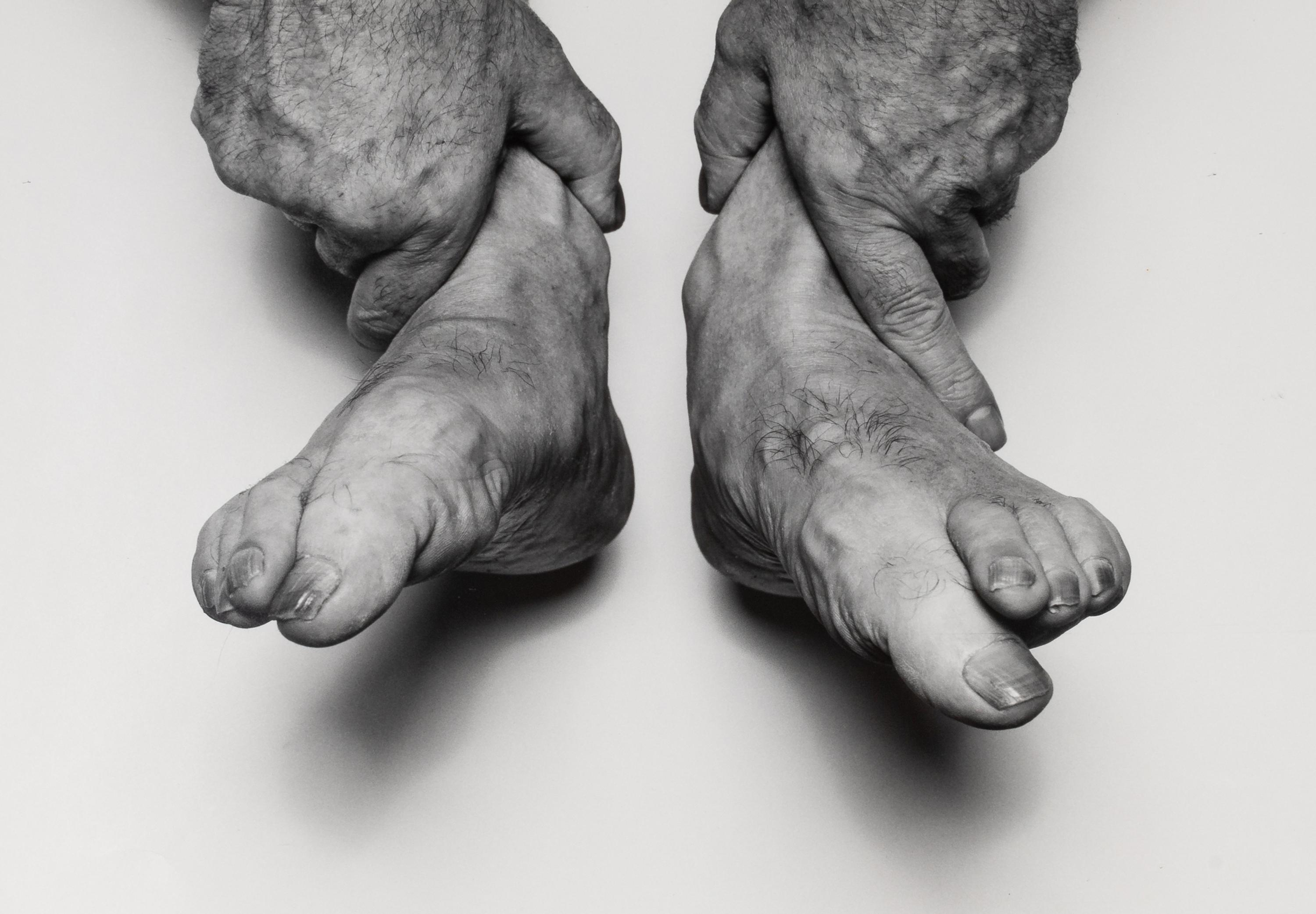John Coplans (1920-2003) Hands Holding Feet, 1985