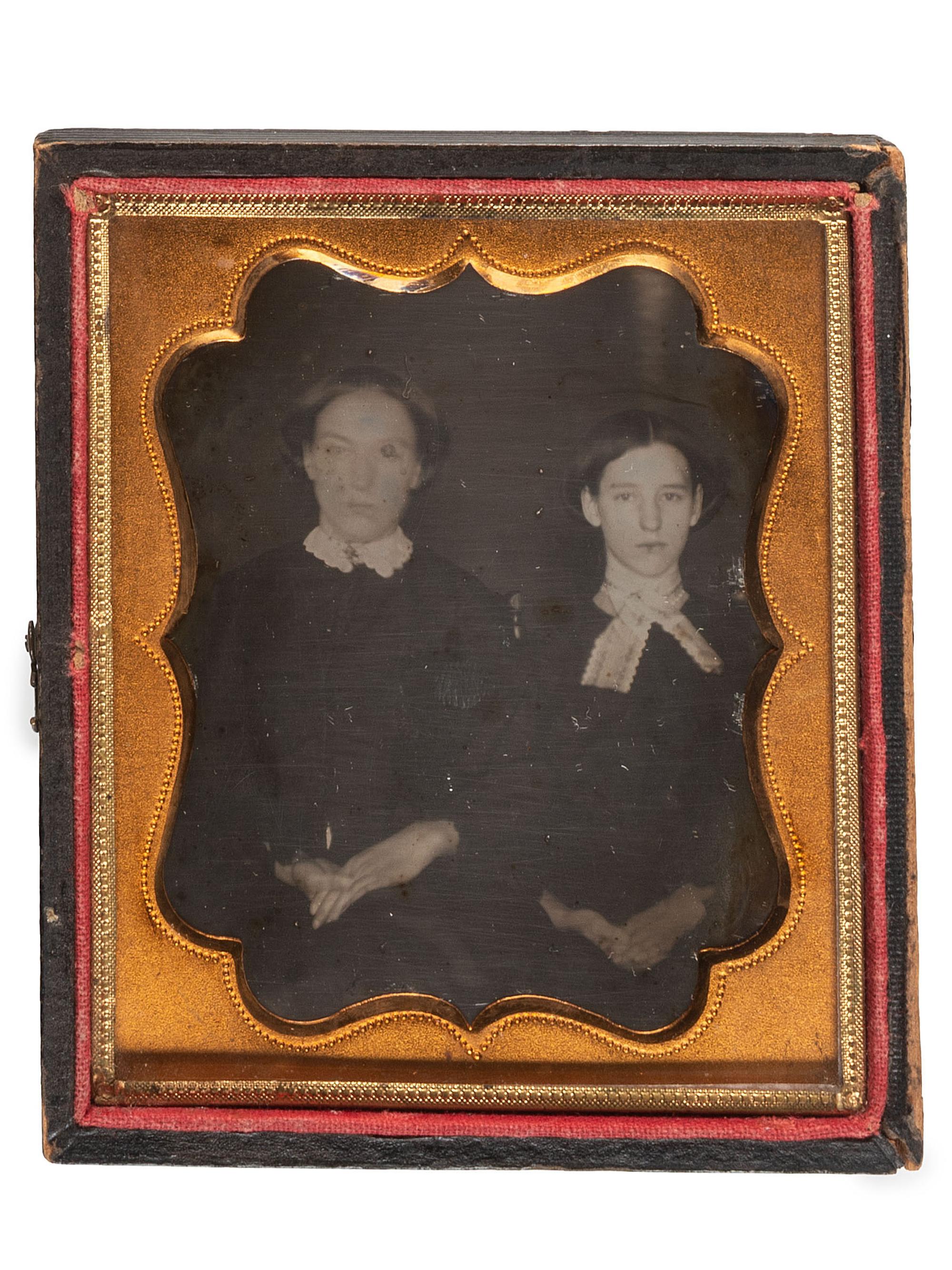 [EARLY PHOTOGRAPHY]. A pair of sixth plate daguerreotypes featuring subjects with physical deformities, comprising: