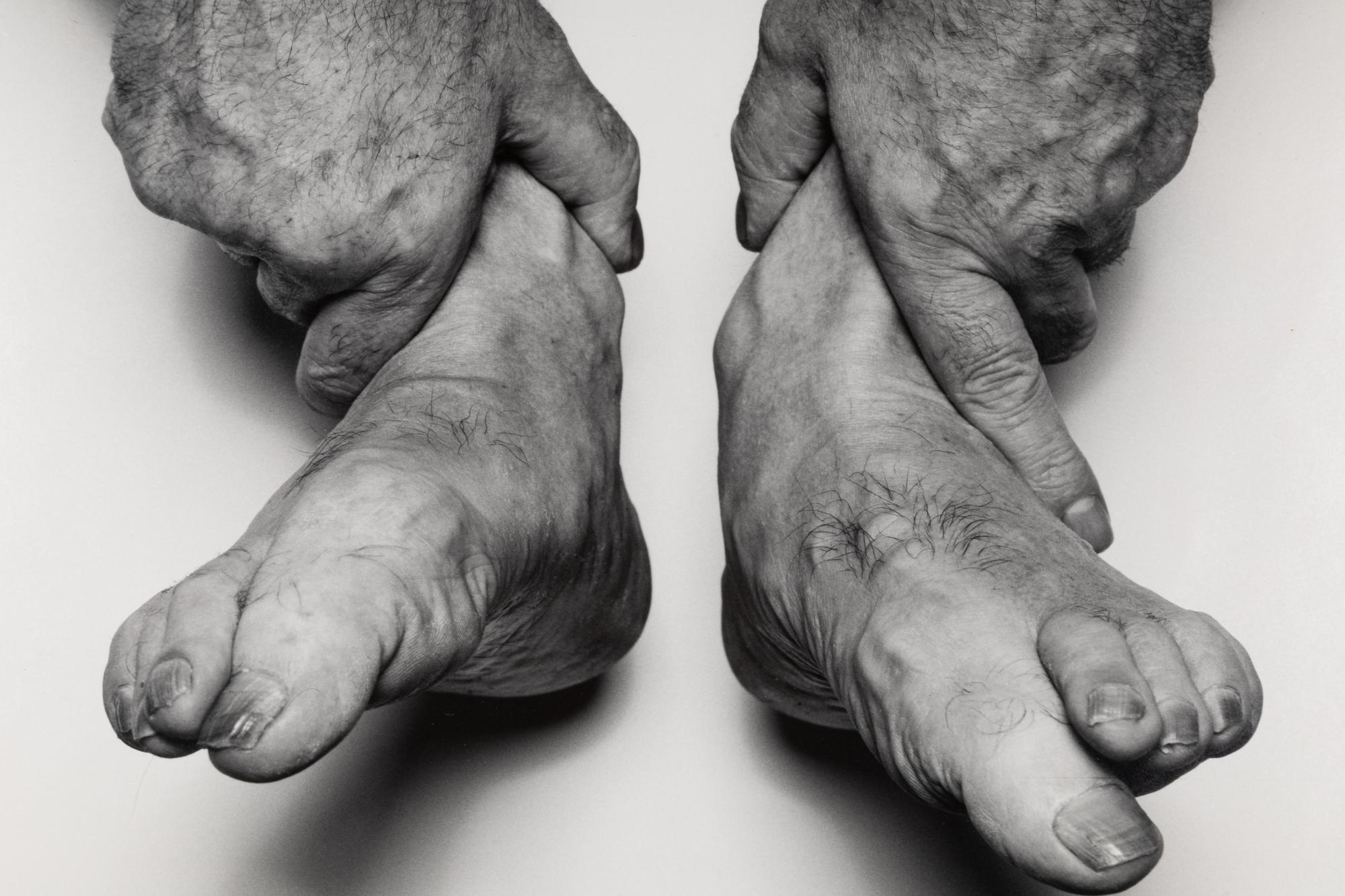 John Coplans (1920-2003) Hands Holding Feet, 1985