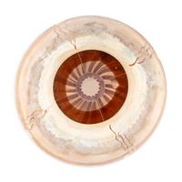 Spherical Vase