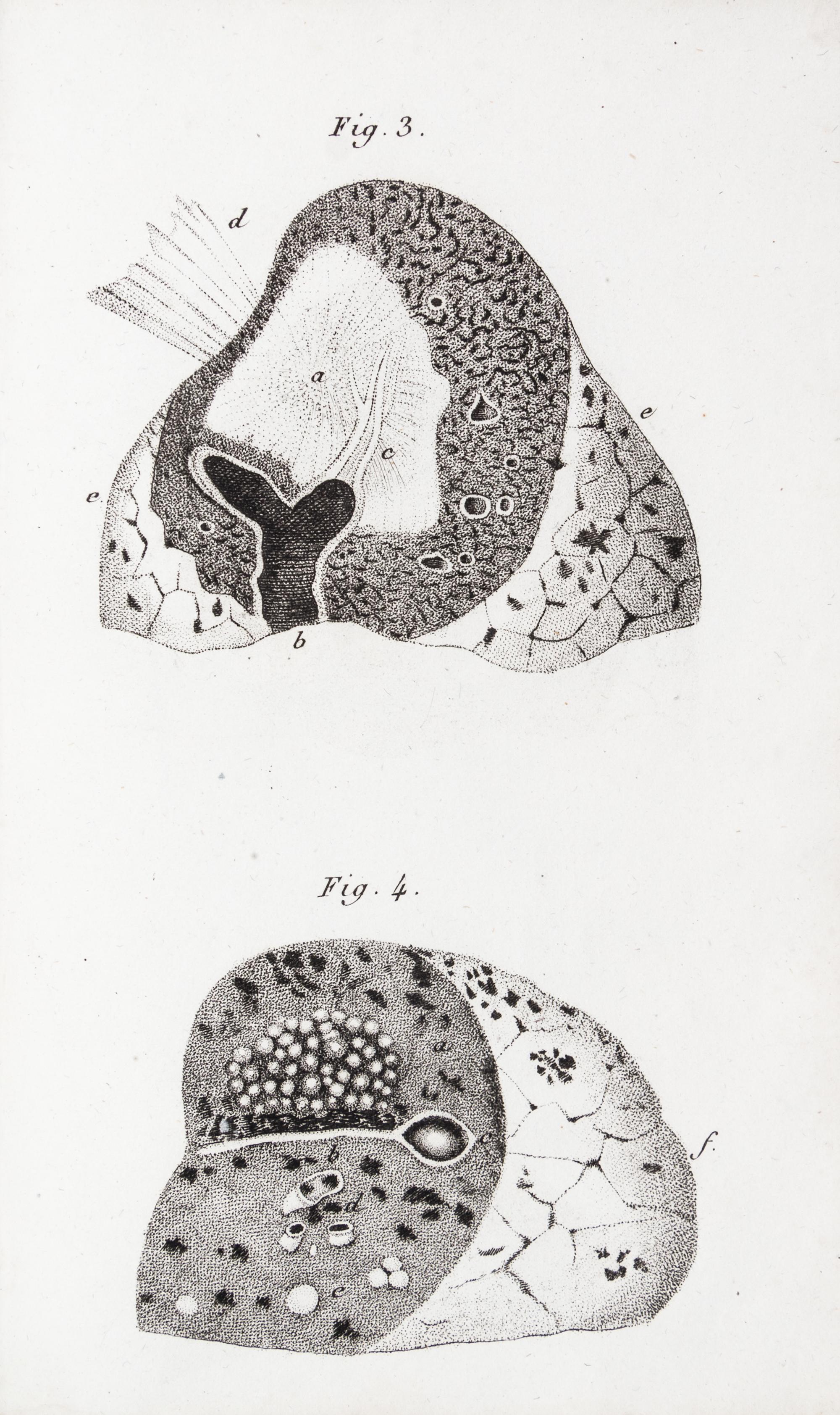 LAENNEC, R.T. Traite de L'Auscultation mediate... Paris, 1826. 2 vols. Second edition.