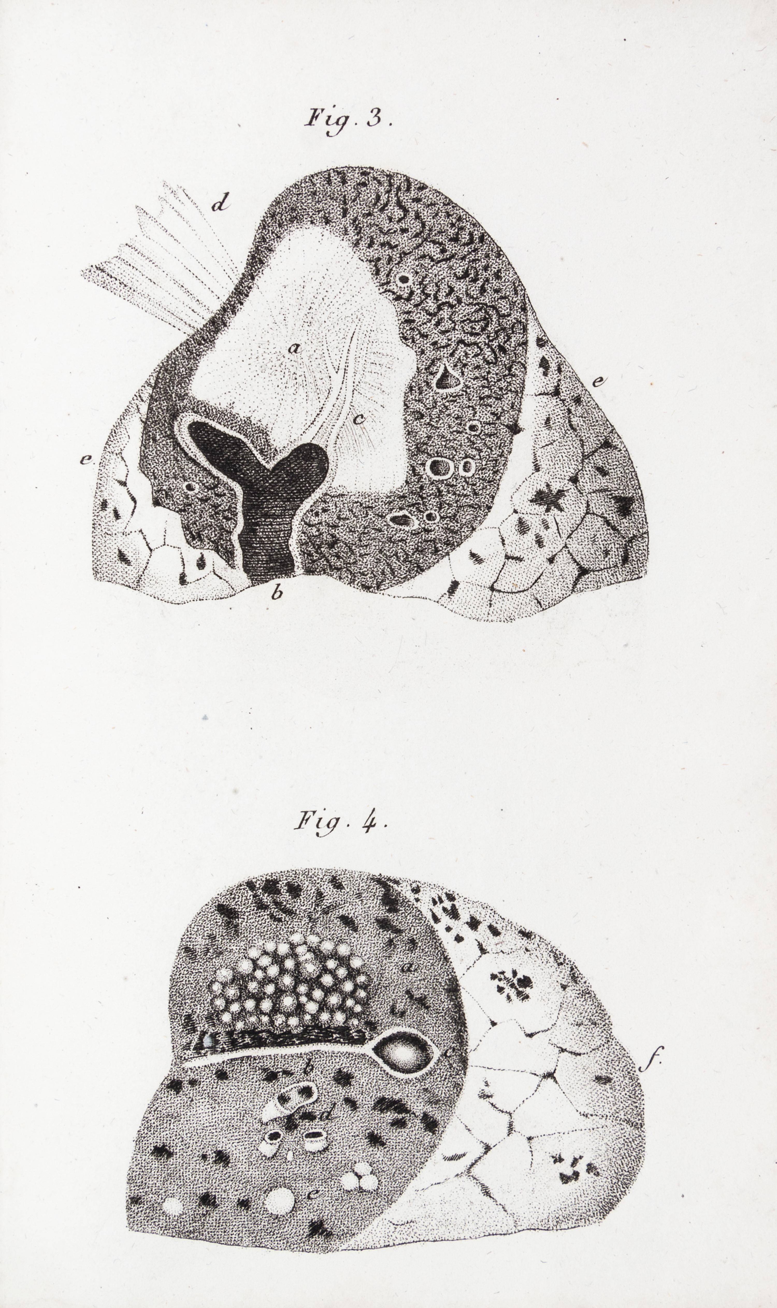LAENNEC, R.T. Traite de L'Auscultation mediate... Paris, 1826. 2 vols. Second edition.