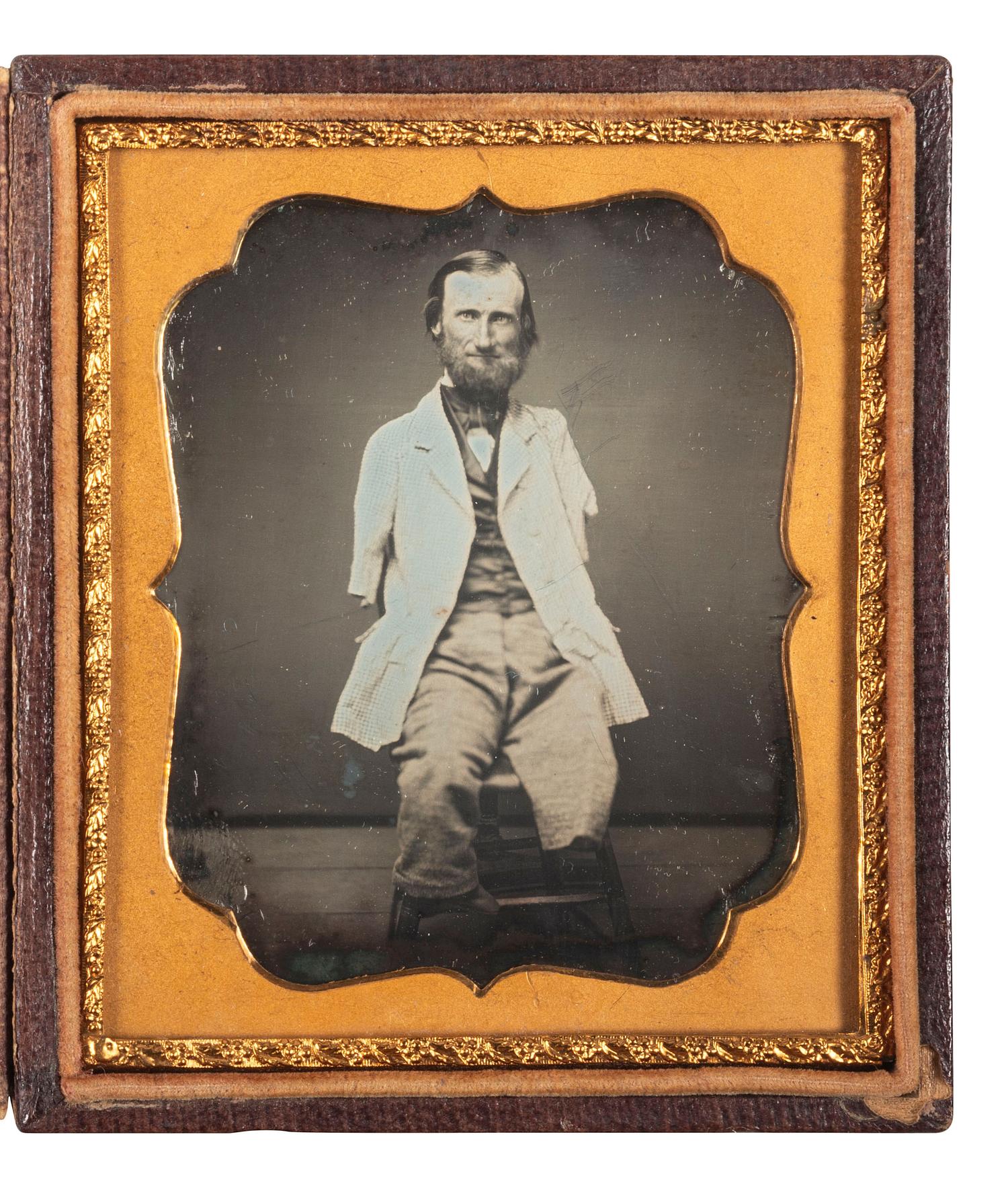 [EARLY PHOTOGRAPHY]. Sixth plate daguerreotype featuring a man with no arms and only one leg.