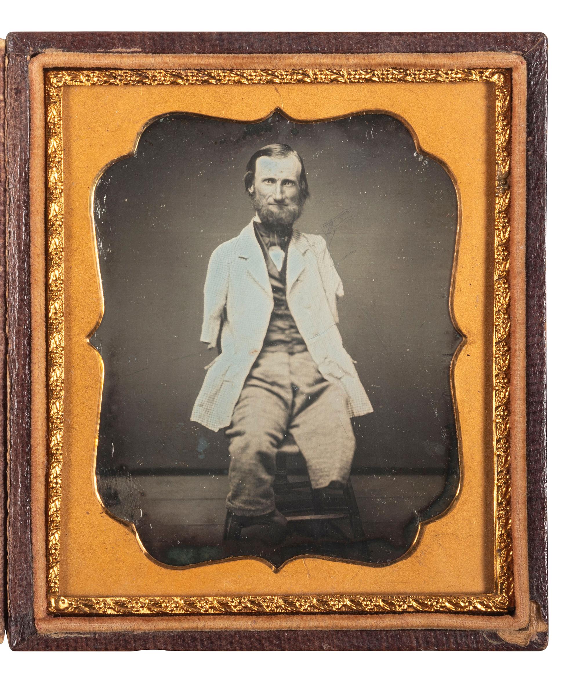 [EARLY PHOTOGRAPHY]. Sixth plate daguerreotype featuring a man with no arms and only one leg.