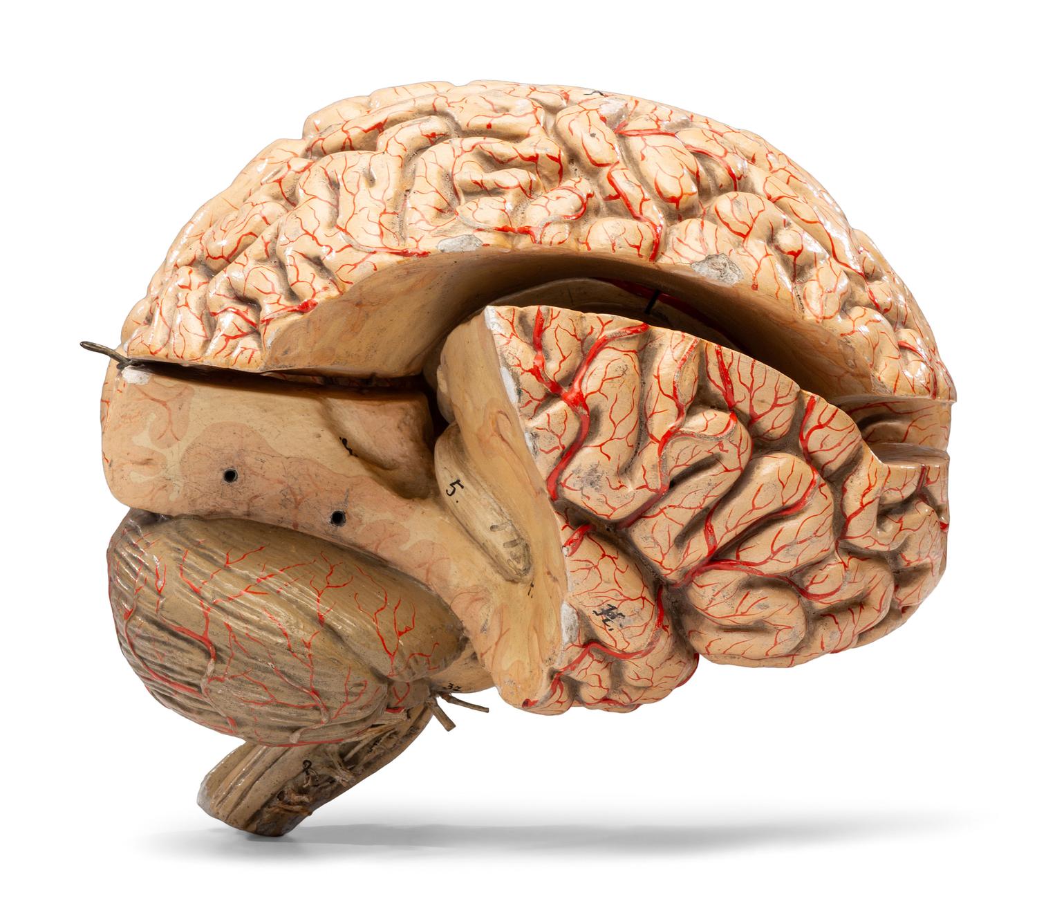 A Painted Plaster Brain Section Model