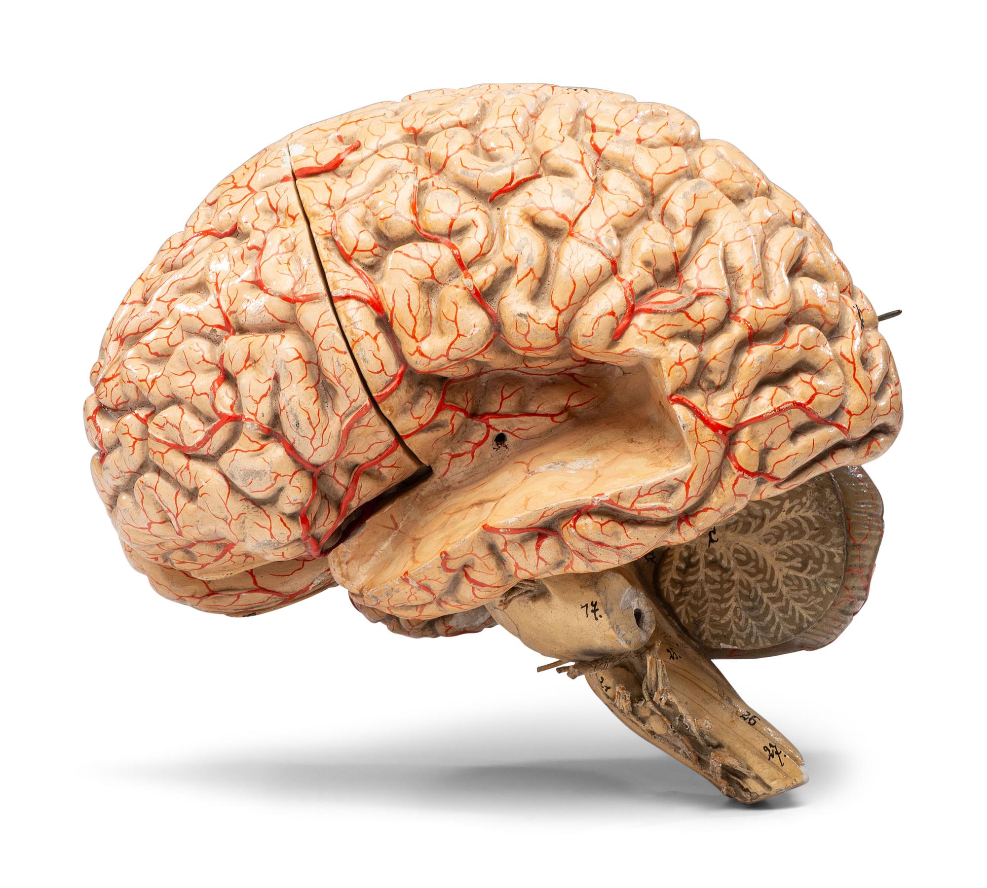 A Painted Plaster Brain Section Model