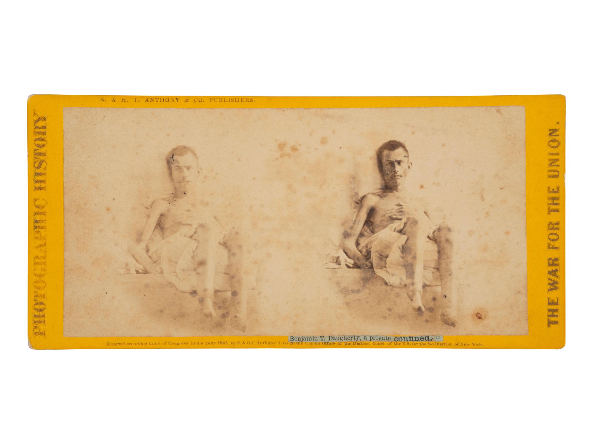 [CIVIL WAR]. Stereoview of Benjamin T. Daugherty, an Andersonville prisoner. New York: E. & H. T. Anthony & Co., 1865.