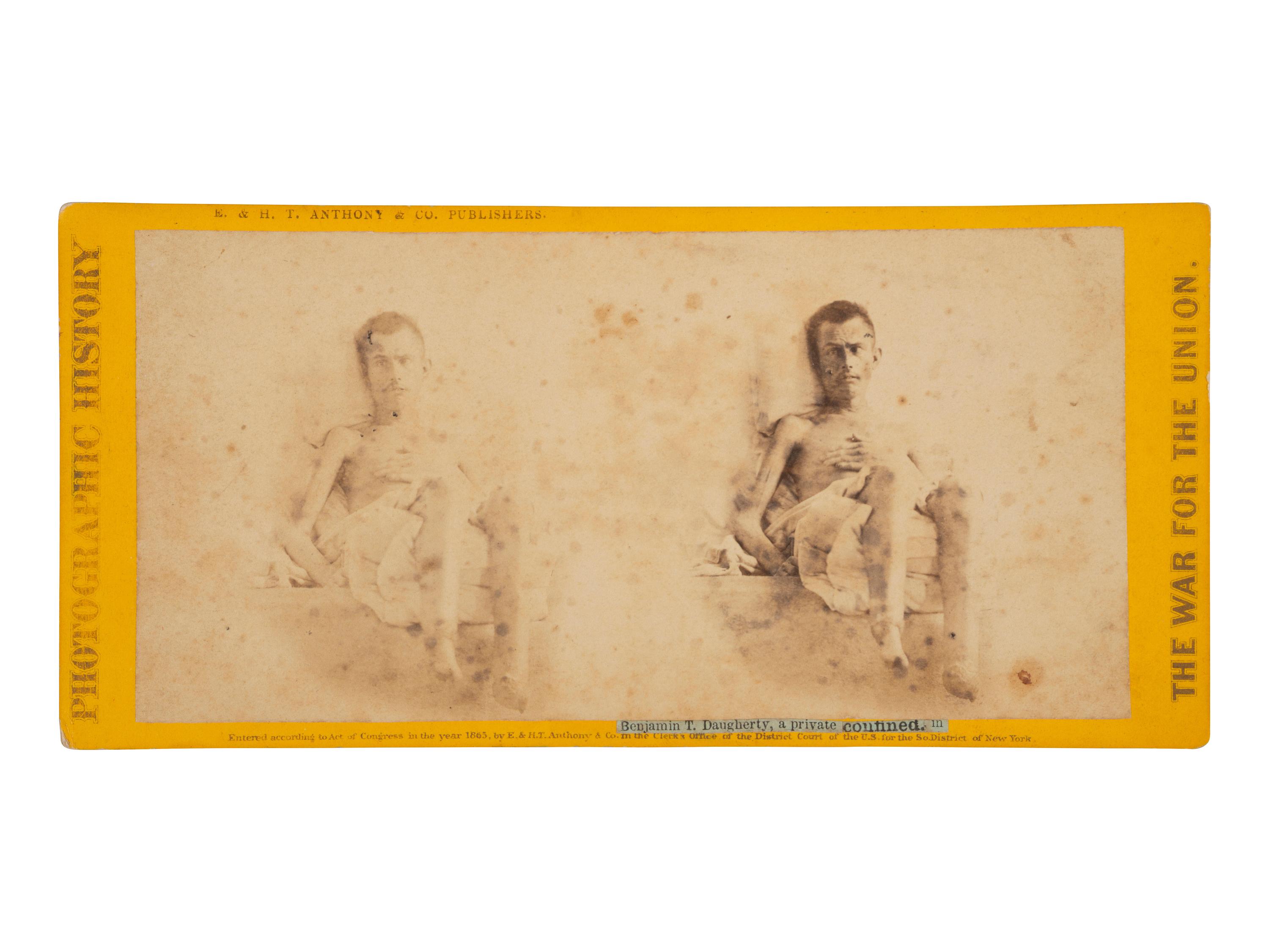 [CIVIL WAR]. Stereoview of Benjamin T. Daugherty, an Andersonville prisoner. New York: E. & H. T. Anthony & Co., 1865.