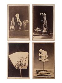 [CIVIL WAR]. A group of 5 CDVs of medical specimens issued by the Surgeon General's Office, Army Medical Museum. [Washington, DC], ca 1860s.