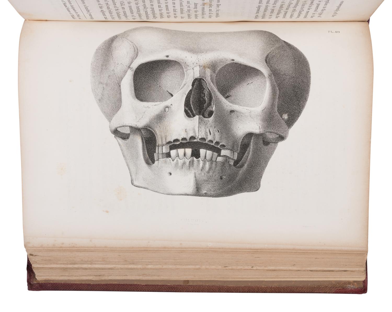 SCHOOLCRAFT, Henry Rowe (1793-1864). Information, respecting the History, Condition and Prospects of the Indian Tribes of the United States . Philadelphia: Lippincott, Grambo & Company, 1853-1856.