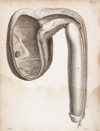 HUNTER, JOHN. A Treatise on the Venereal Disease. London, 1786. First edition.