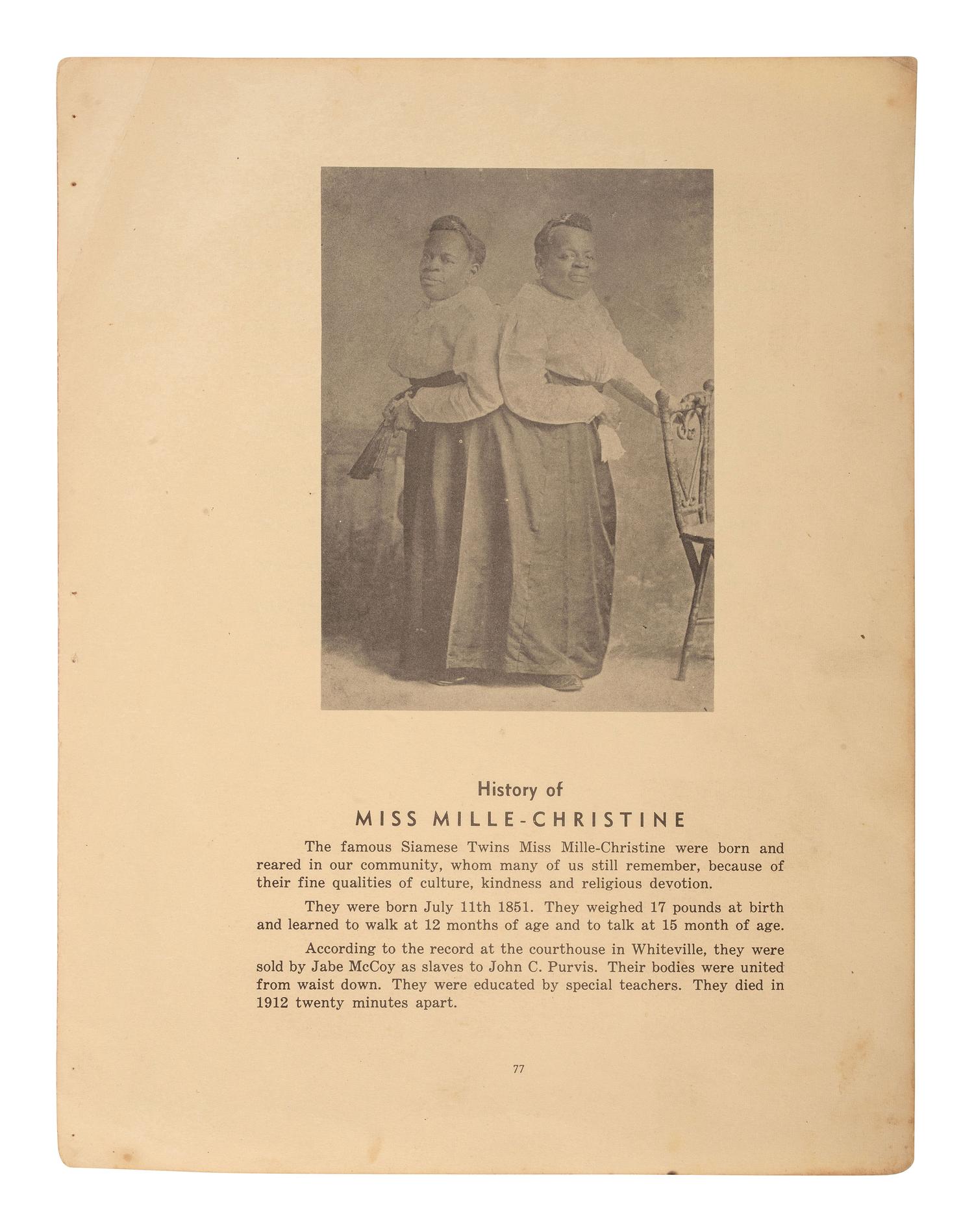 [MUSIC] -- [McKOY, Millie and Christine (1851-1912)]. HUGHES & Co., photographers. CDV of the famous conjoined twins from North Carolina. St. Louis, ca 1860s.