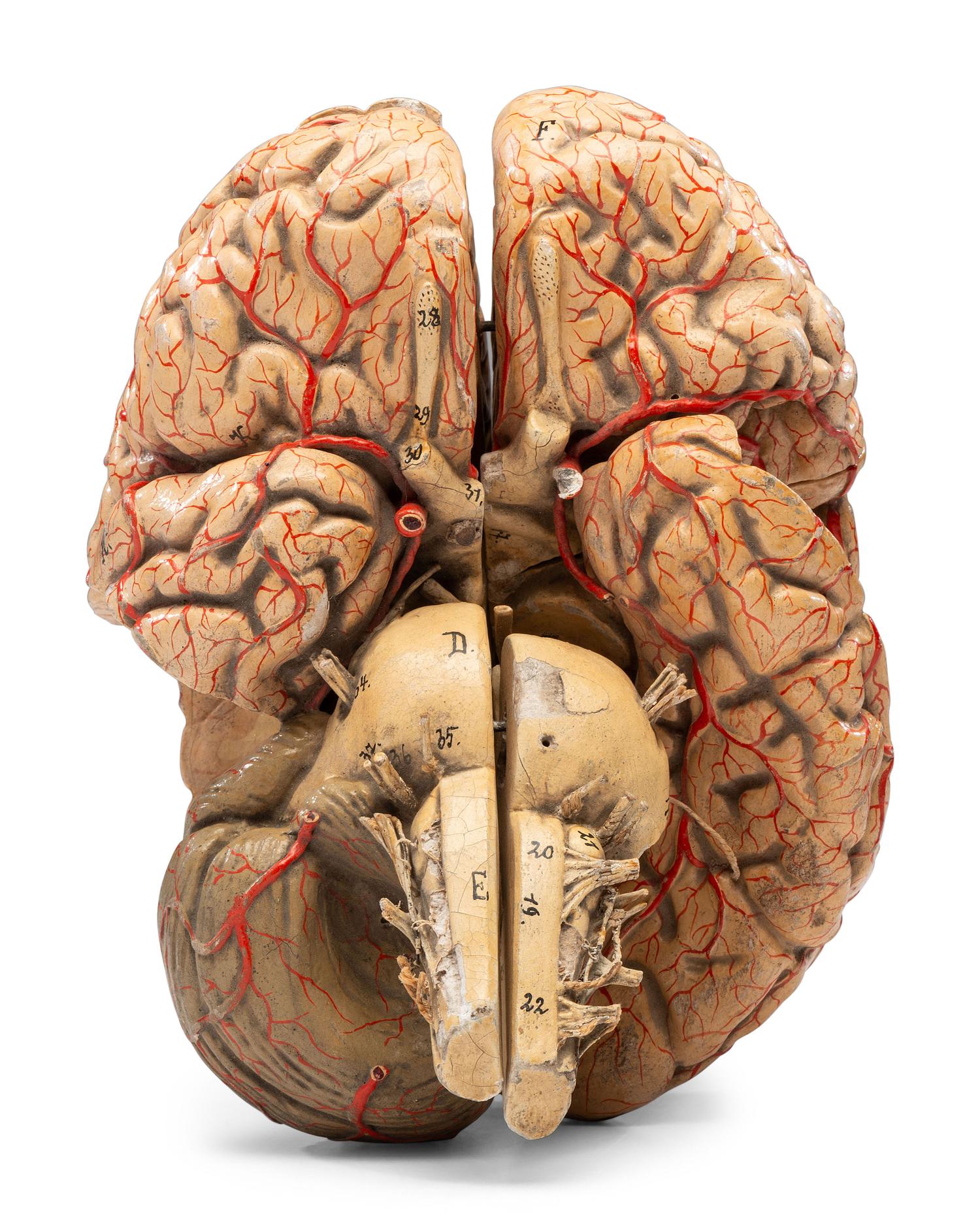 A Painted Plaster Brain Section Model