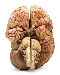 A Painted Plaster Brain Section Model