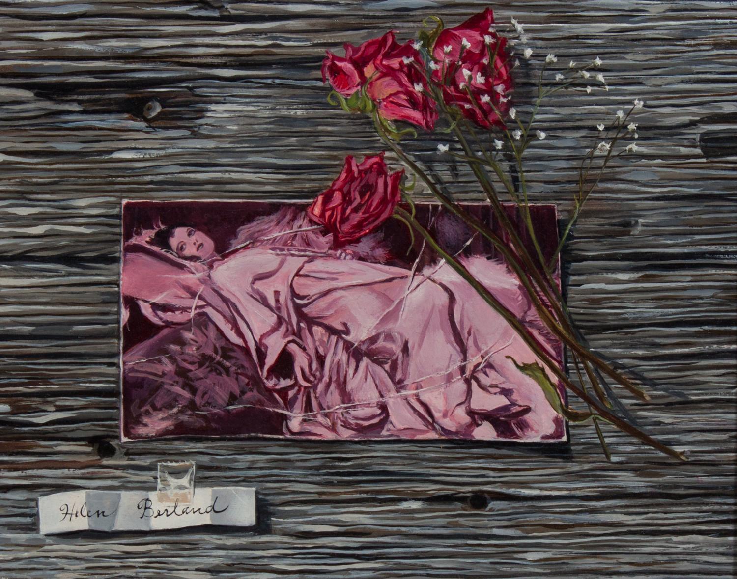 Helen Berland, (Wisconsin, 1915-1986), Let Me Tell You About My Operation