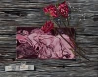 Helen Berland, (Wisconsin, 1915-1986), Let Me Tell You About My Operation