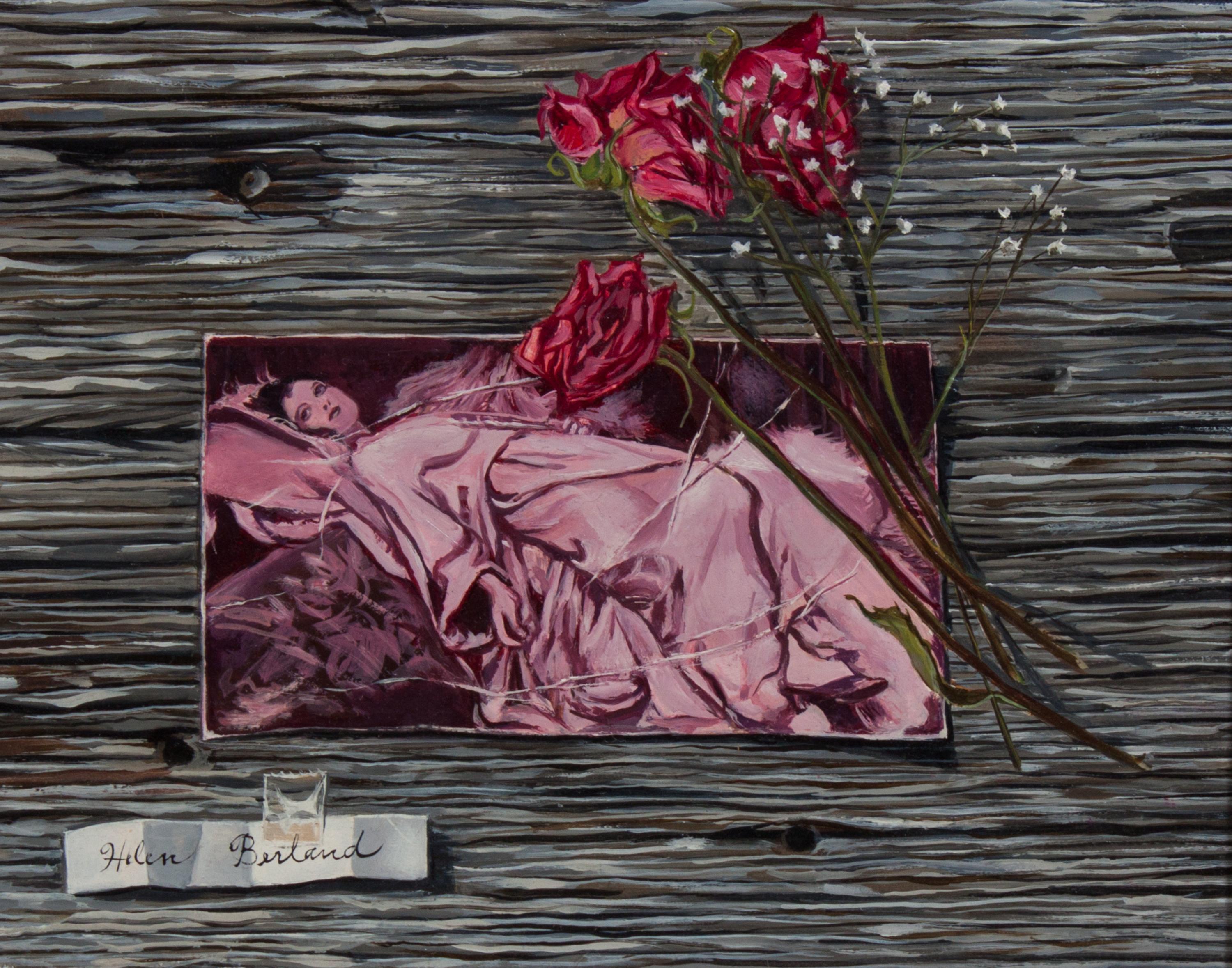 Helen Berland, (Wisconsin, 1915-1986), Let Me Tell You About My Operation