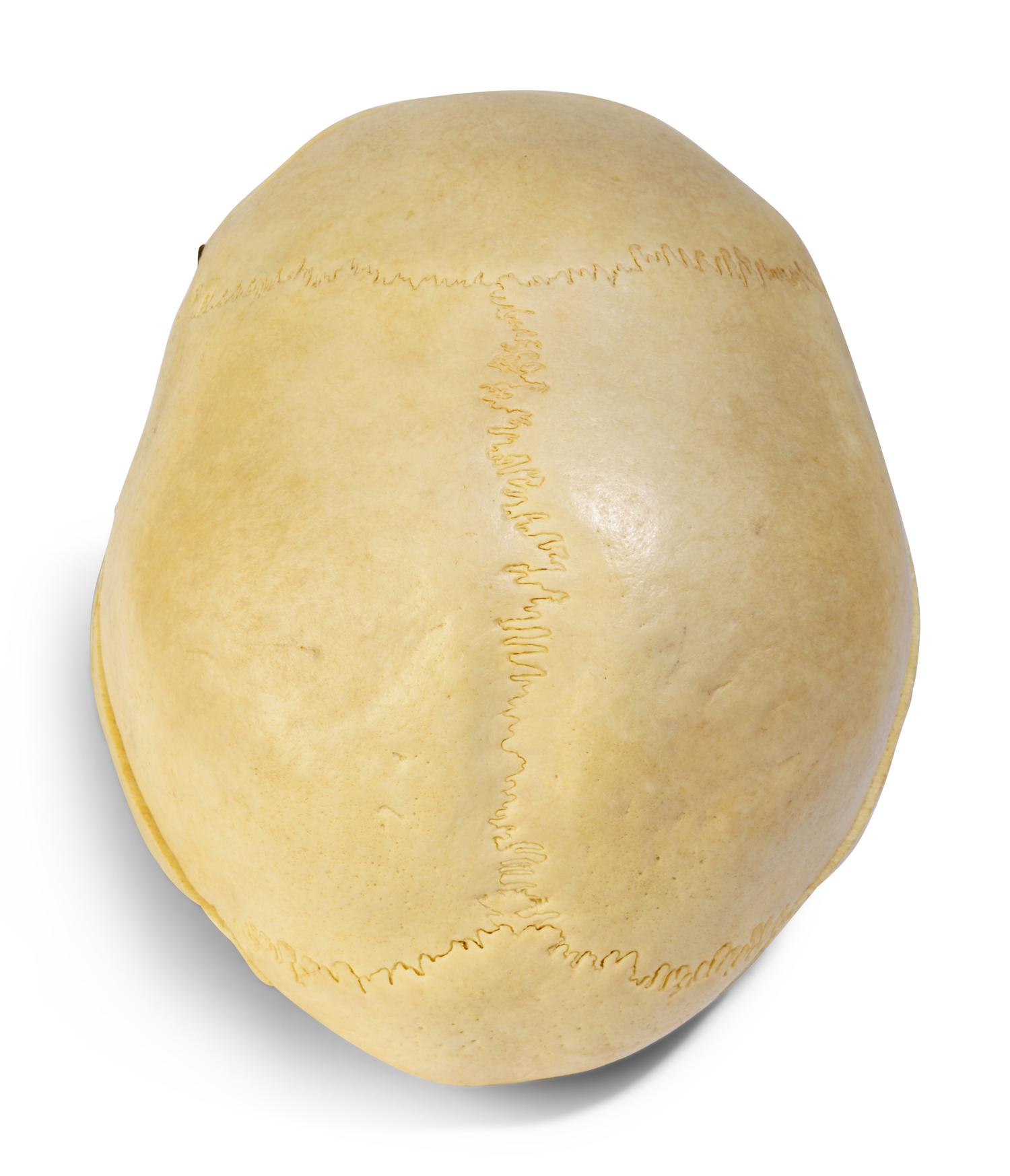 A European Medical Instruction Human Skull