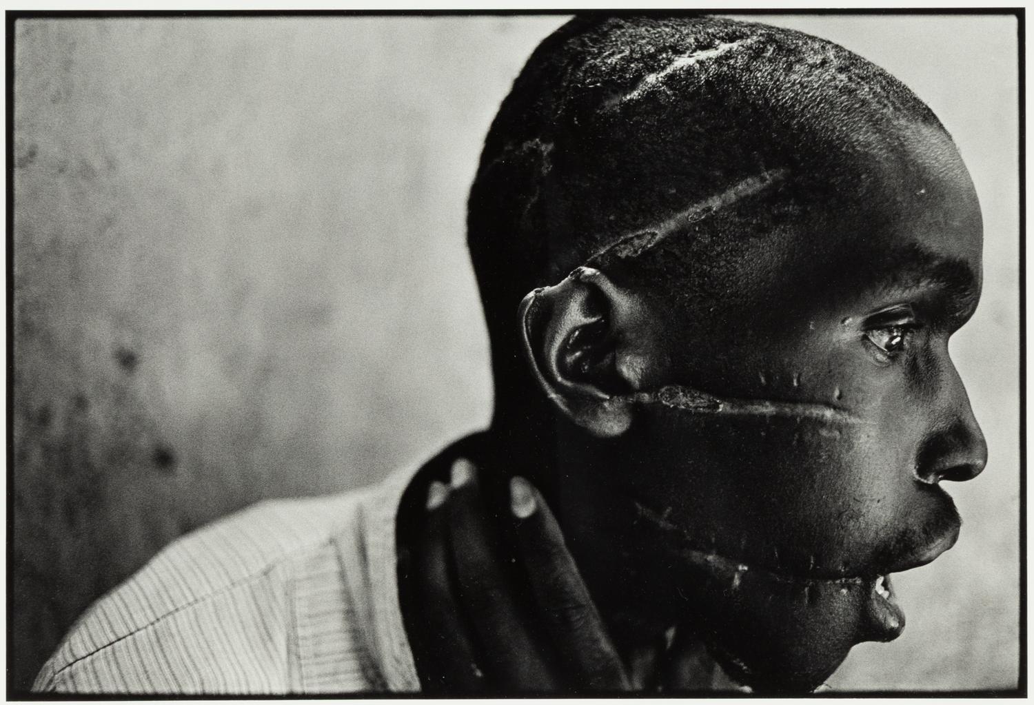 Survivor of Hutu death camp, Rwanda , June 1994