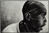 Survivor of Hutu death camp, Rwanda , June 1994