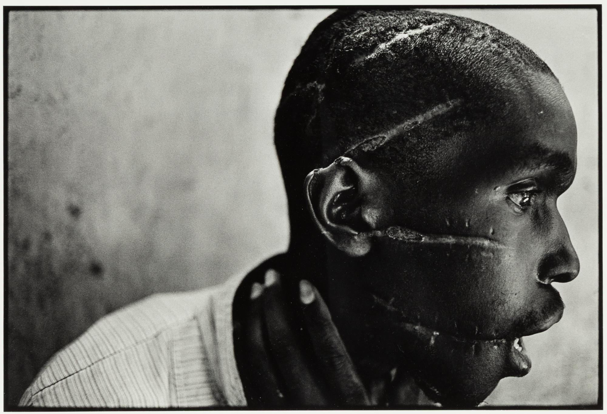 Survivor of Hutu death camp, Rwanda , June 1994