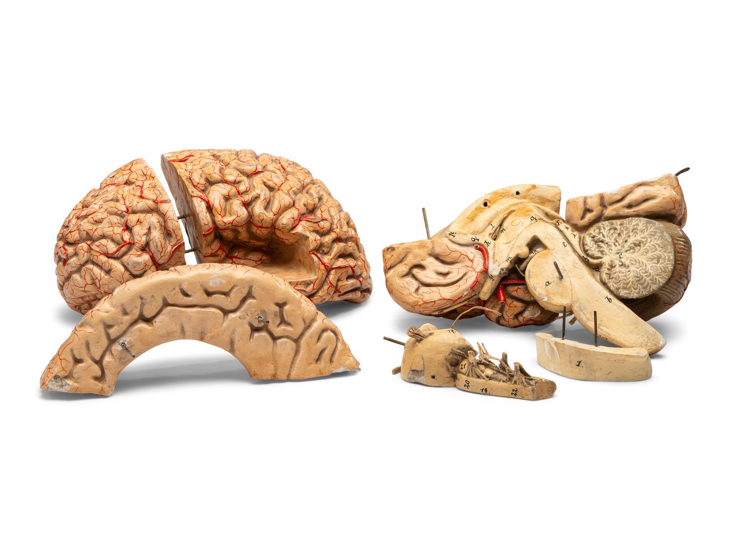 A Painted Plaster Brain Section Model