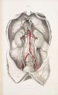 (ANATOMY) QUAIN, JONES AND ERASMUS WILSON, eds. The Vessels of the Human Body; in a Series of Plates... London, 1846. Part two of five.