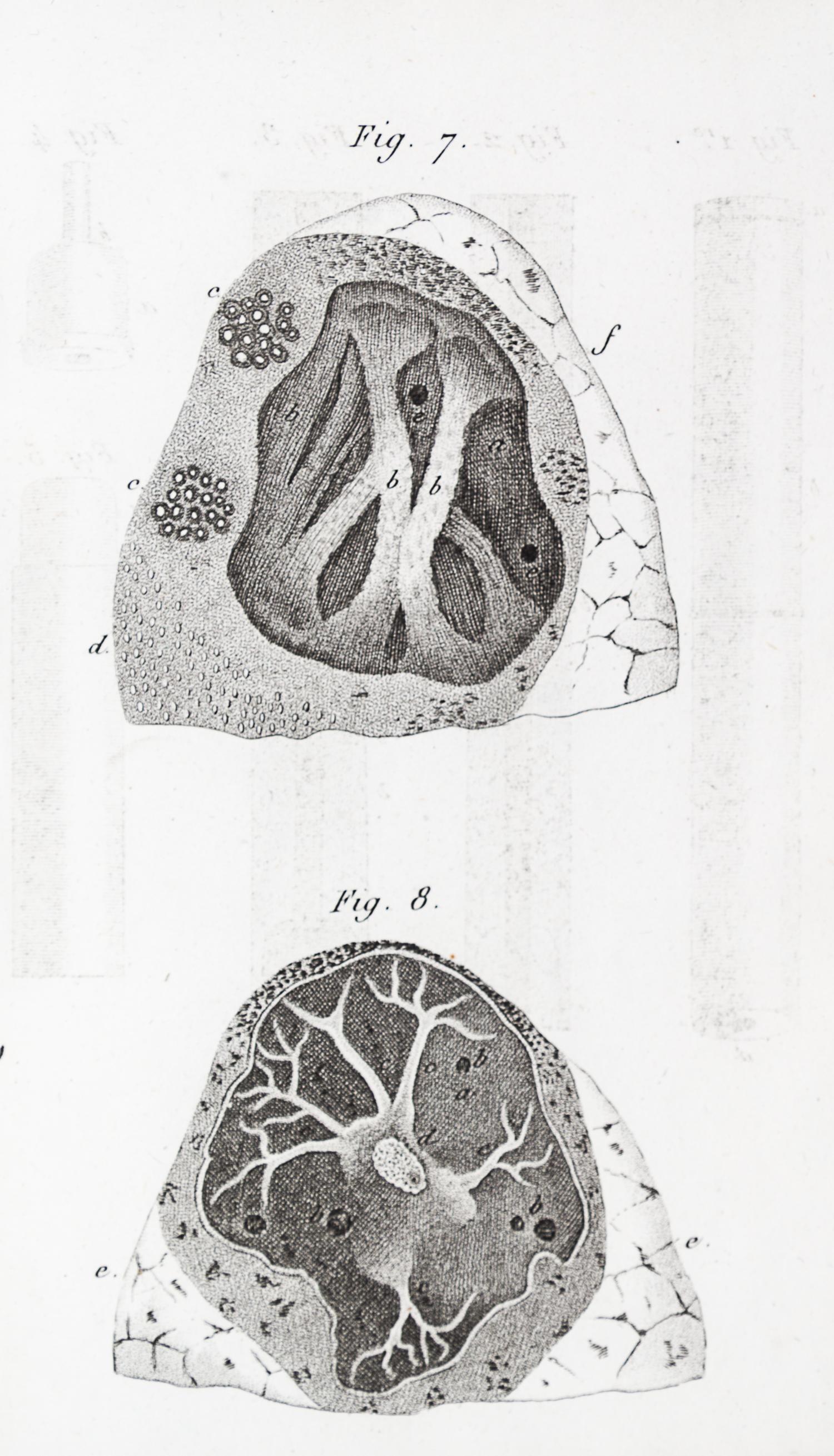 LAENNEC, R.T. Traite de L'Auscultation mediate... Paris, 1826. 2 vols. Second edition.