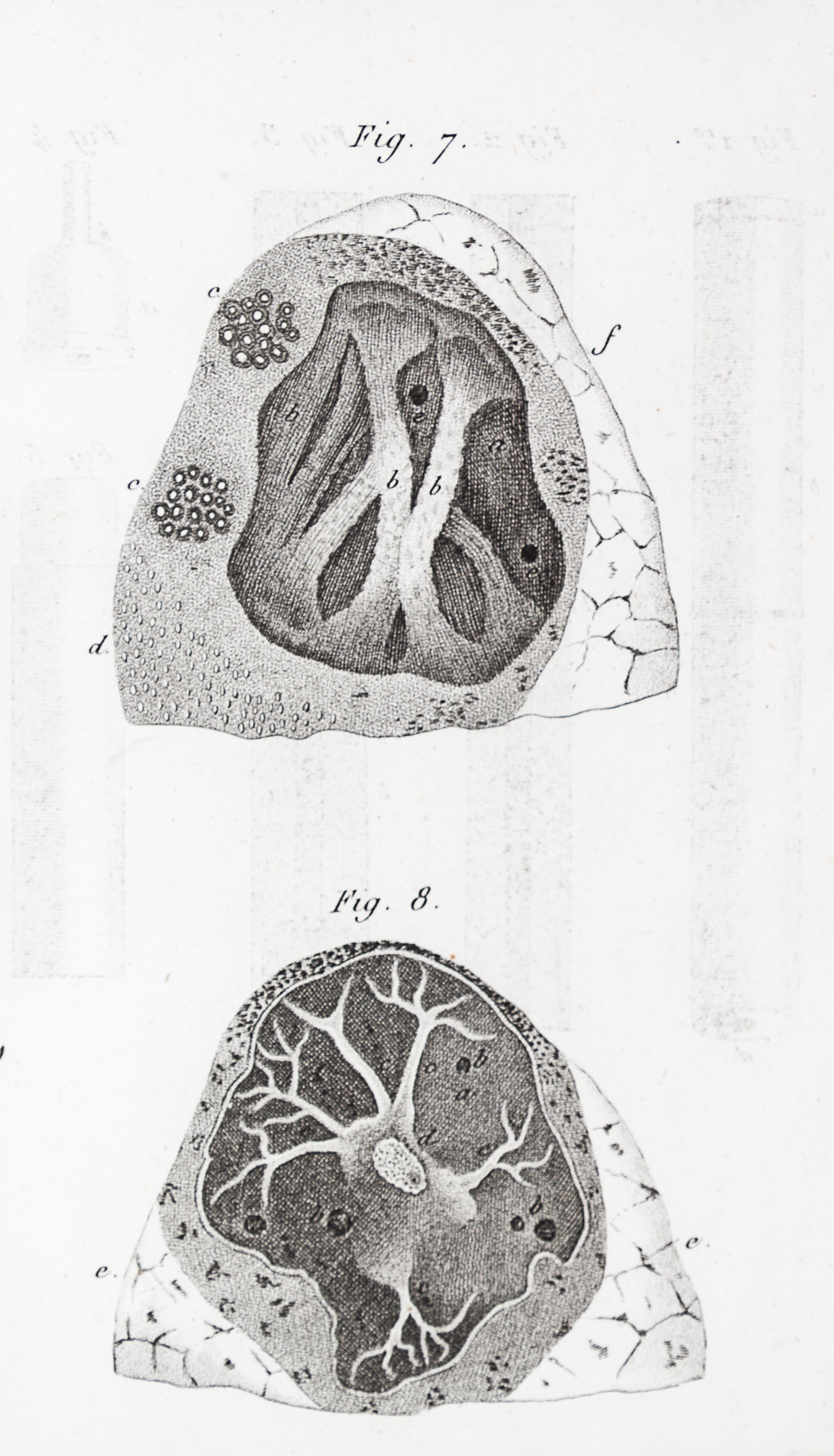 LAENNEC, R.T. Traite de L'Auscultation mediate... Paris, 1826. 2 vols. Second edition.