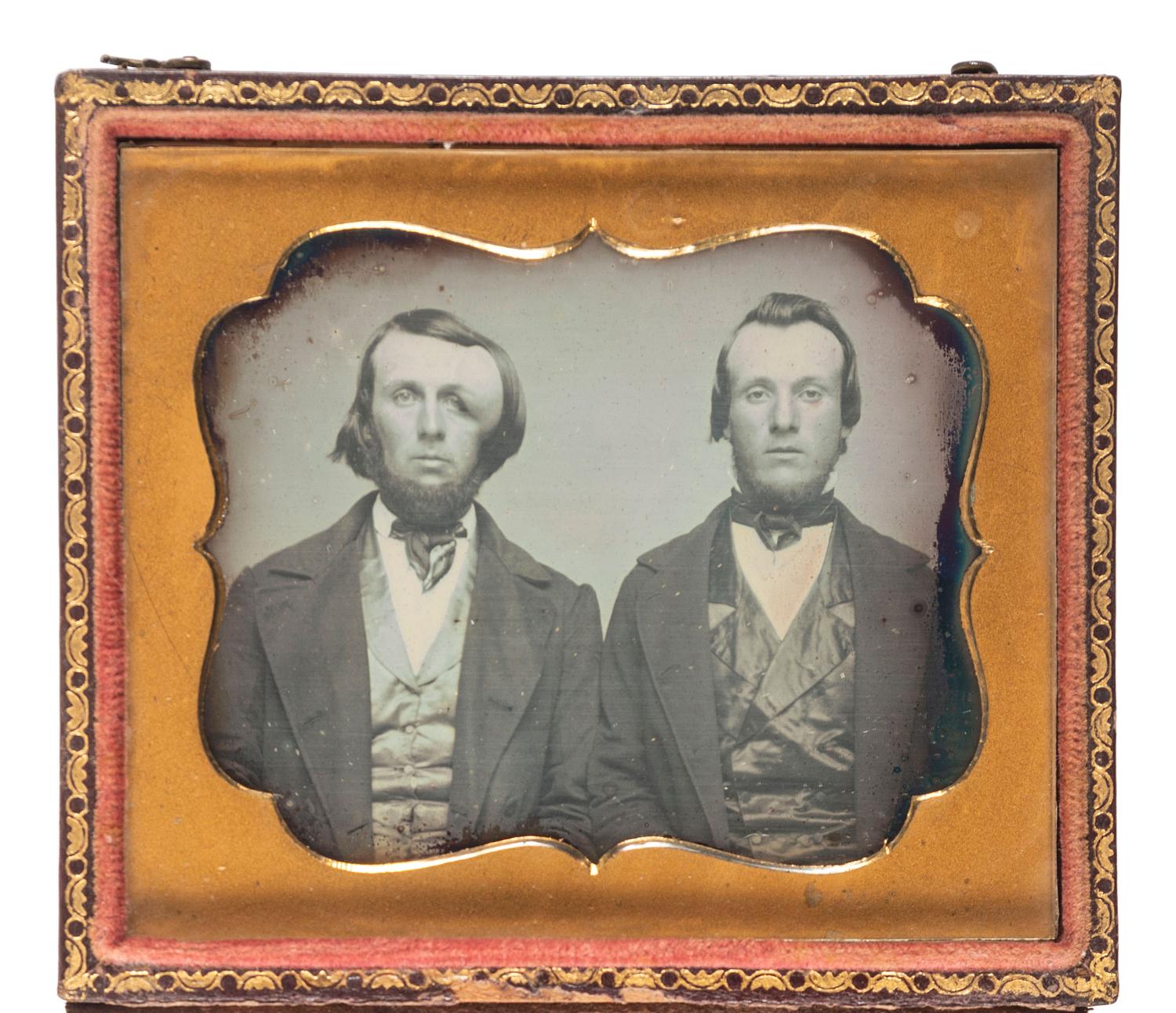 [EARLY PHOTOGRAPHY]. A pair of sixth plate daguerreotypes featuring subjects with physical deformities, comprising: