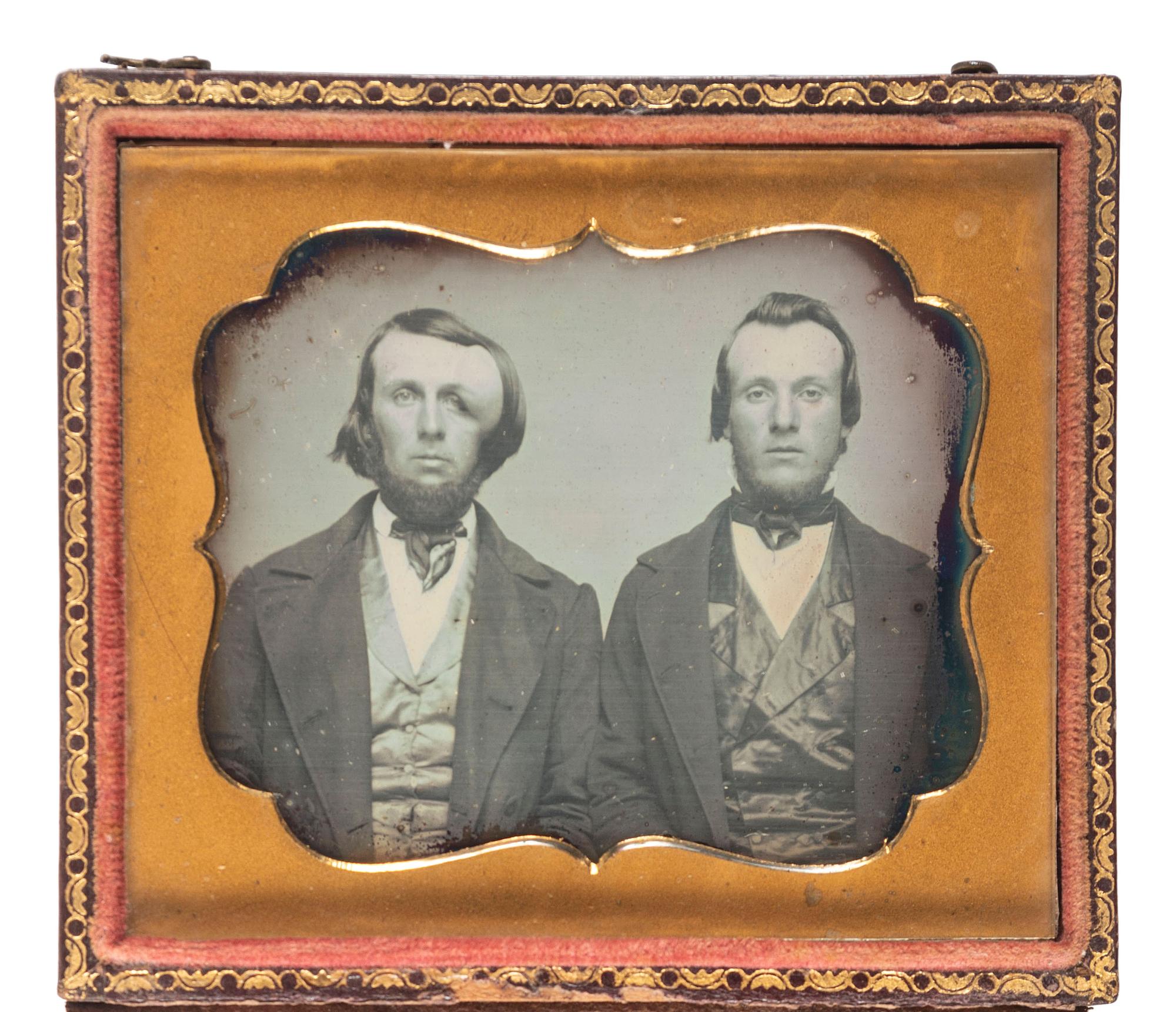 [EARLY PHOTOGRAPHY]. A pair of sixth plate daguerreotypes featuring subjects with physical deformities, comprising: