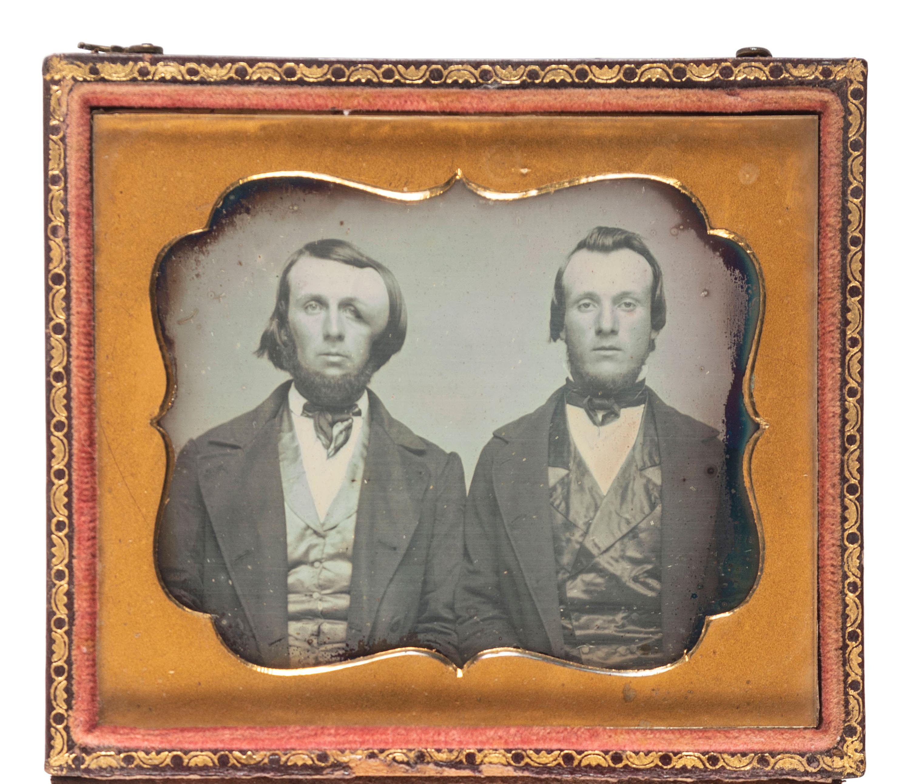[EARLY PHOTOGRAPHY]. A pair of sixth plate daguerreotypes featuring subjects with physical deformities, comprising: