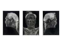 William Anastasi (born 1933) Autobodyography I-III, 1994