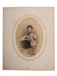 [CIVIL WAR]. Albumen photograph of Private Charles H. Wood, Company D, 53rd Regiment, Pennsylvania Volunteers, wounded Petersburg, Virginia, 31 March 1865, photographed and assembled by Reed Brockway Bontecou, M.D.