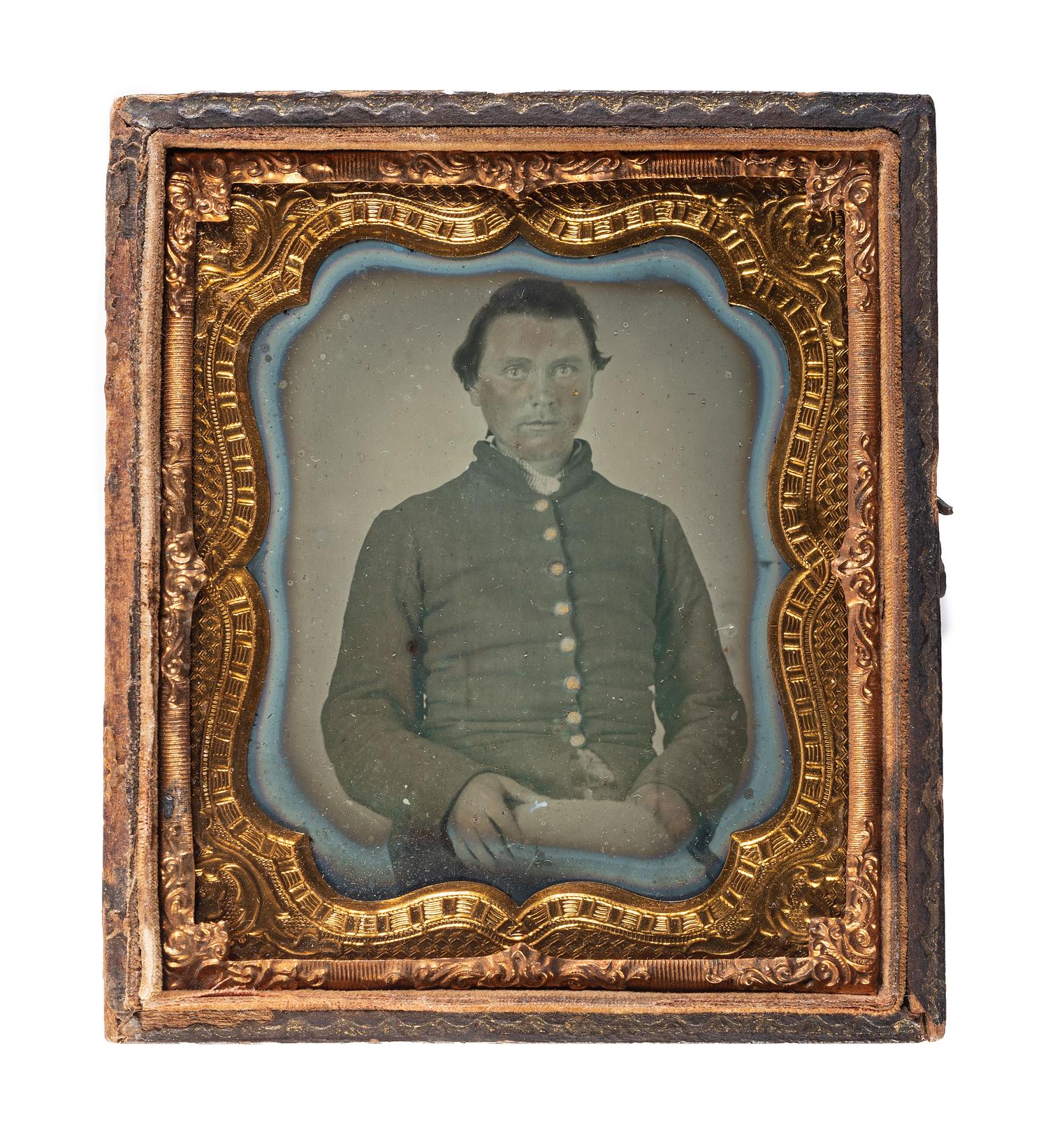 [CIVIL WAR]. Sixth plate ambrotype of CSA soldier identified to Aretos Wade, 51st North Carolina, WIA at Battery Wagner fighting against the 54th Massachusetts Infantry, the famed African American regiment.