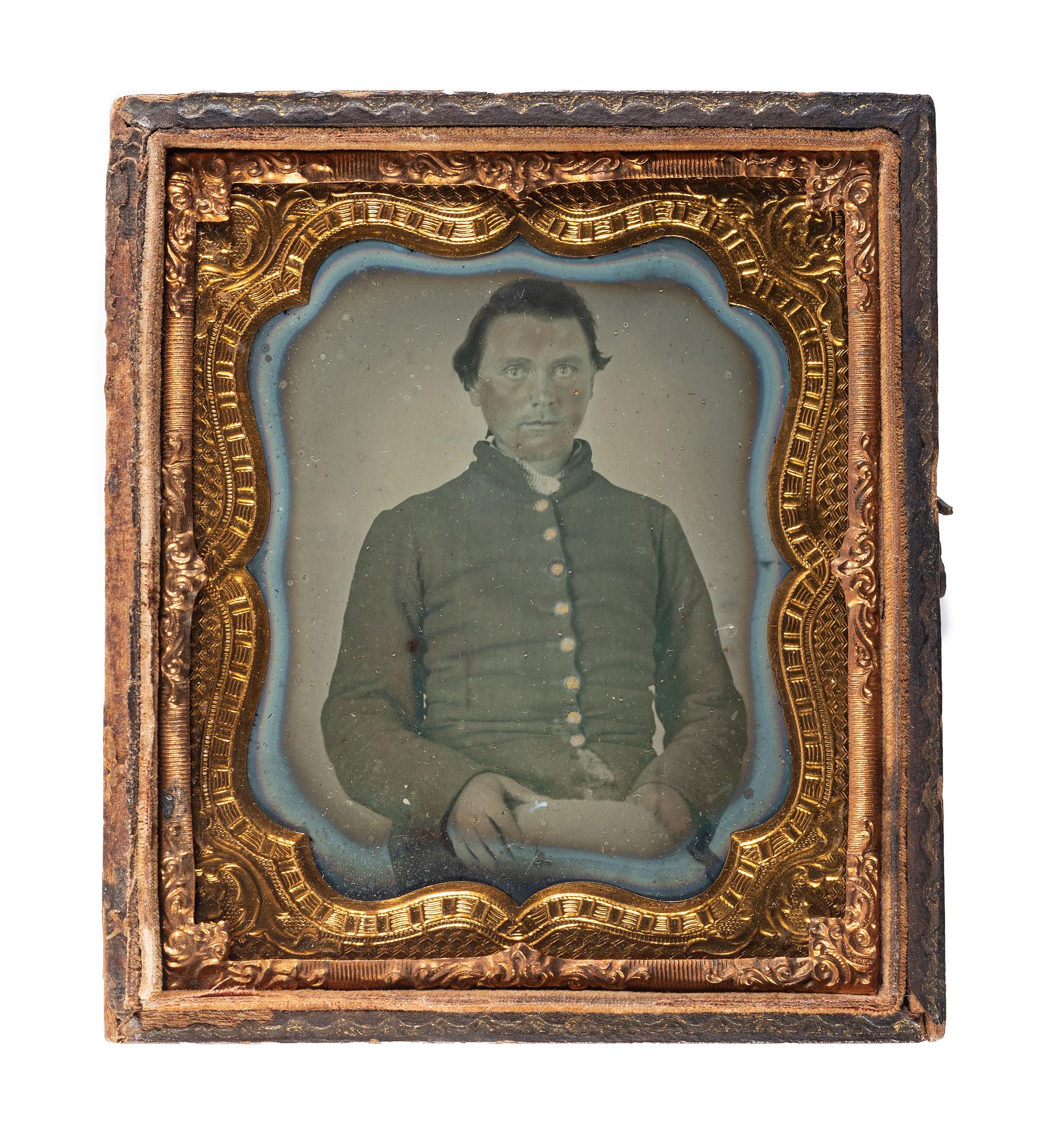 [CIVIL WAR]. Sixth plate ambrotype of CSA soldier identified to Aretos Wade, 51st North Carolina, WIA at Battery Wagner fighting against the 54th Massachusetts Infantry, the famed African American regiment.
