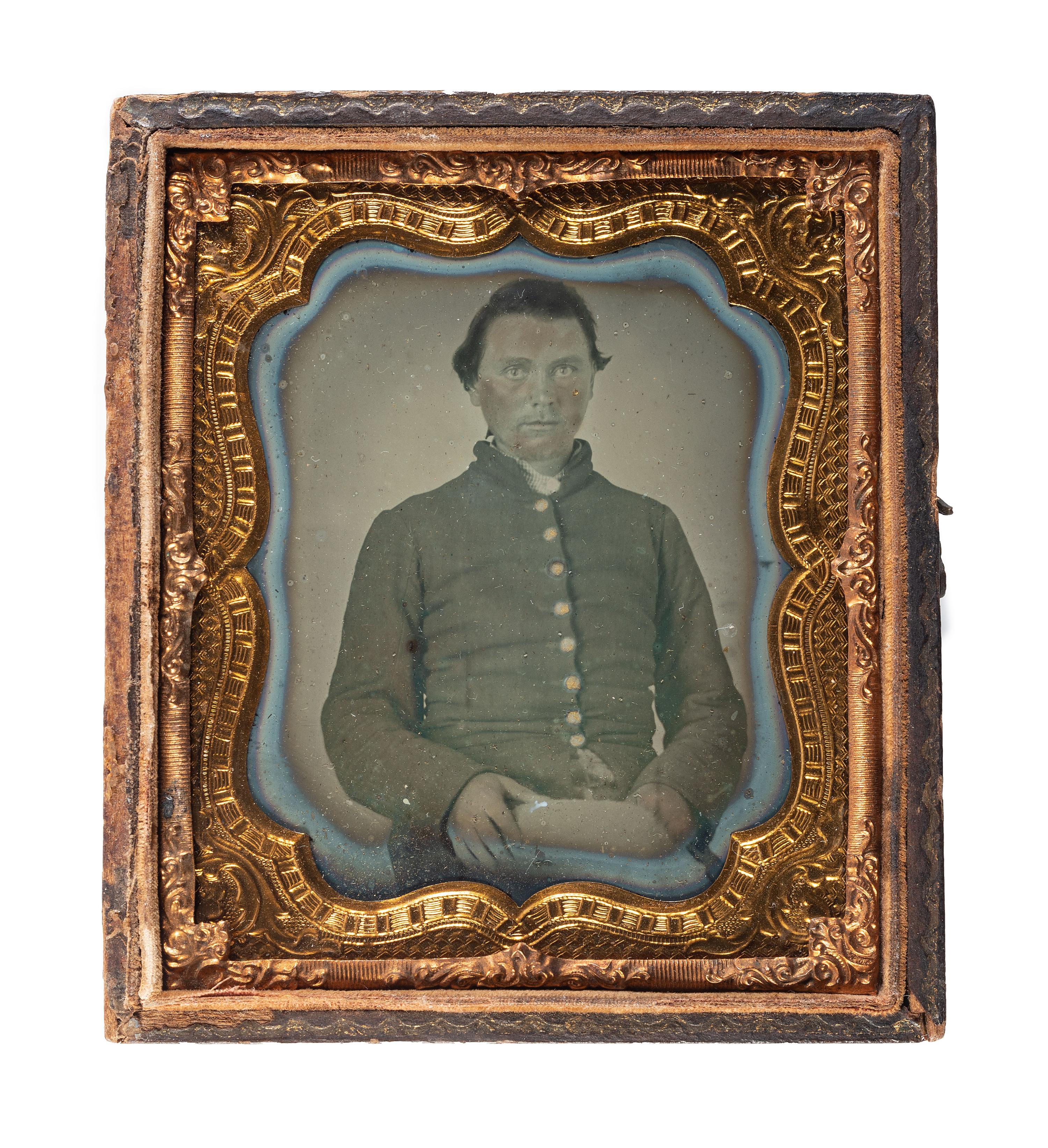 [CIVIL WAR]. Sixth plate ambrotype of CSA soldier identified to Aretos Wade, 51st North Carolina, WIA at Battery Wagner fighting against the 54th Massachusetts Infantry, the famed African American regiment.