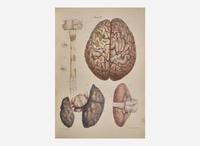 [Science, Medicine & Mathematics] Carswell, Robert: Pathological Anatomy. Illustrations of the Elementary Forms of Disease